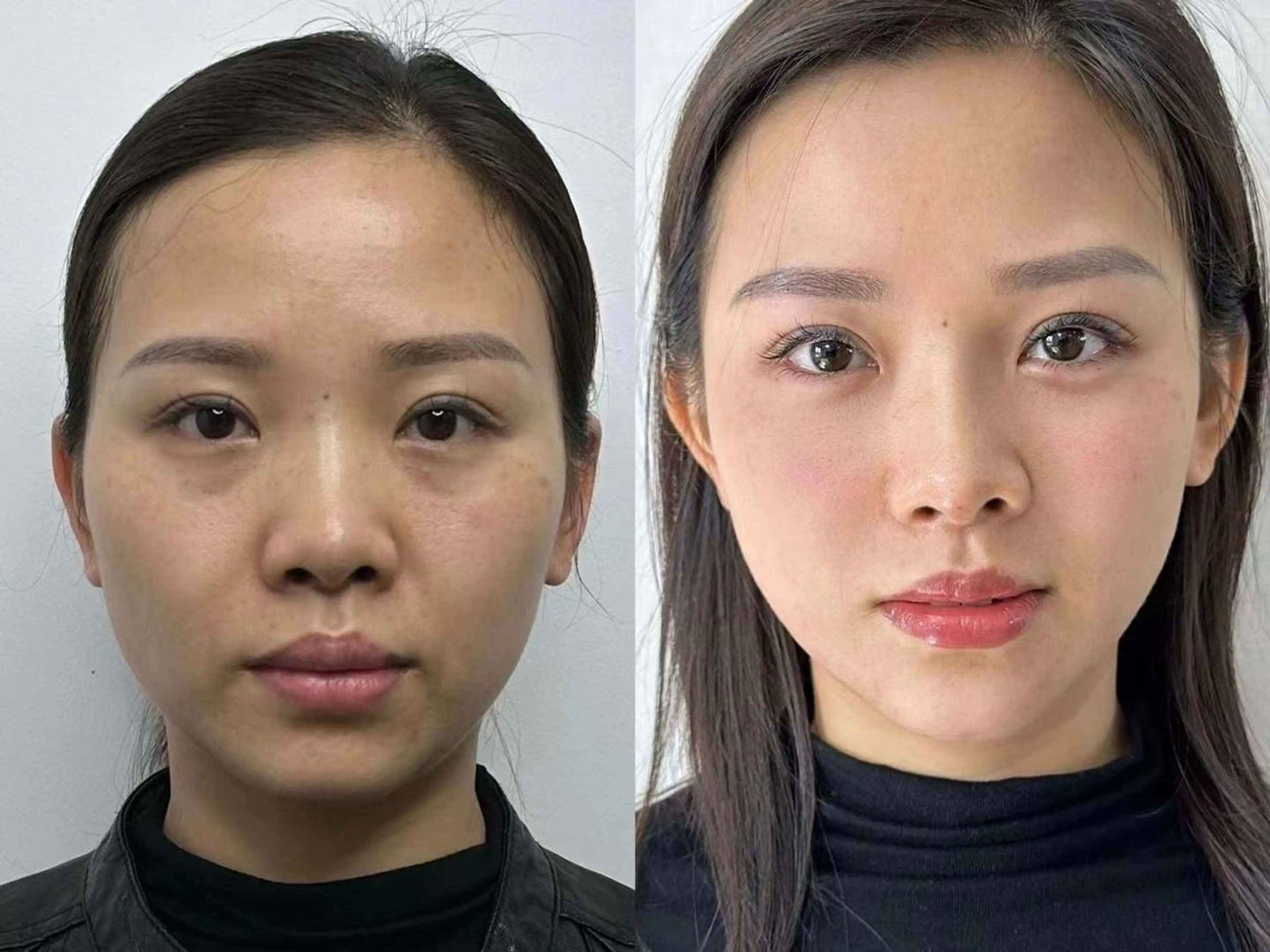 エステ リラク 愛維美水光美肌専門店 メンズレディースokのエステ・リラクイメージ