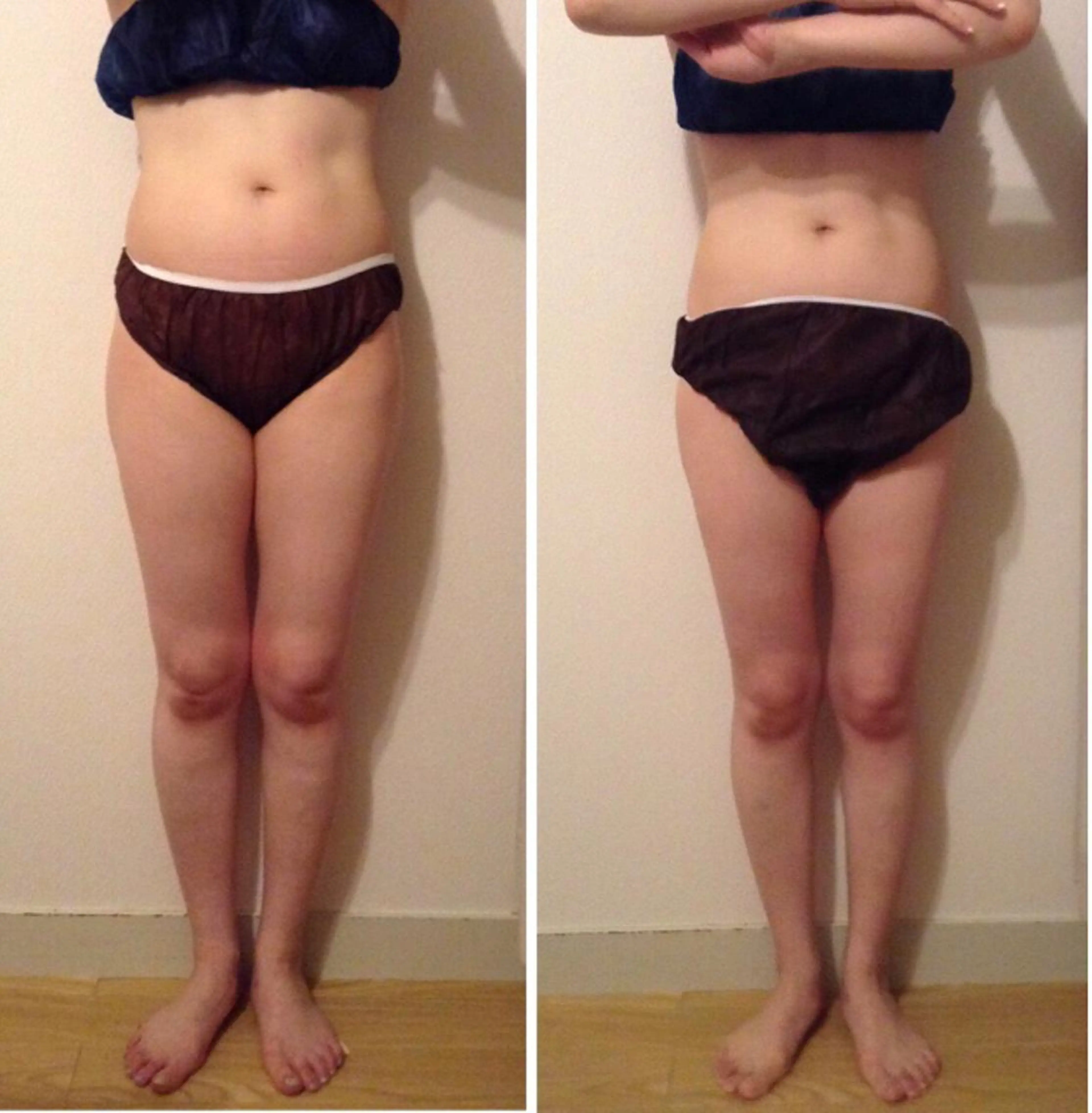 【太もも裏＆ヒップ】ほっそり美脚&小尻コース♪70分★￥5500の写真