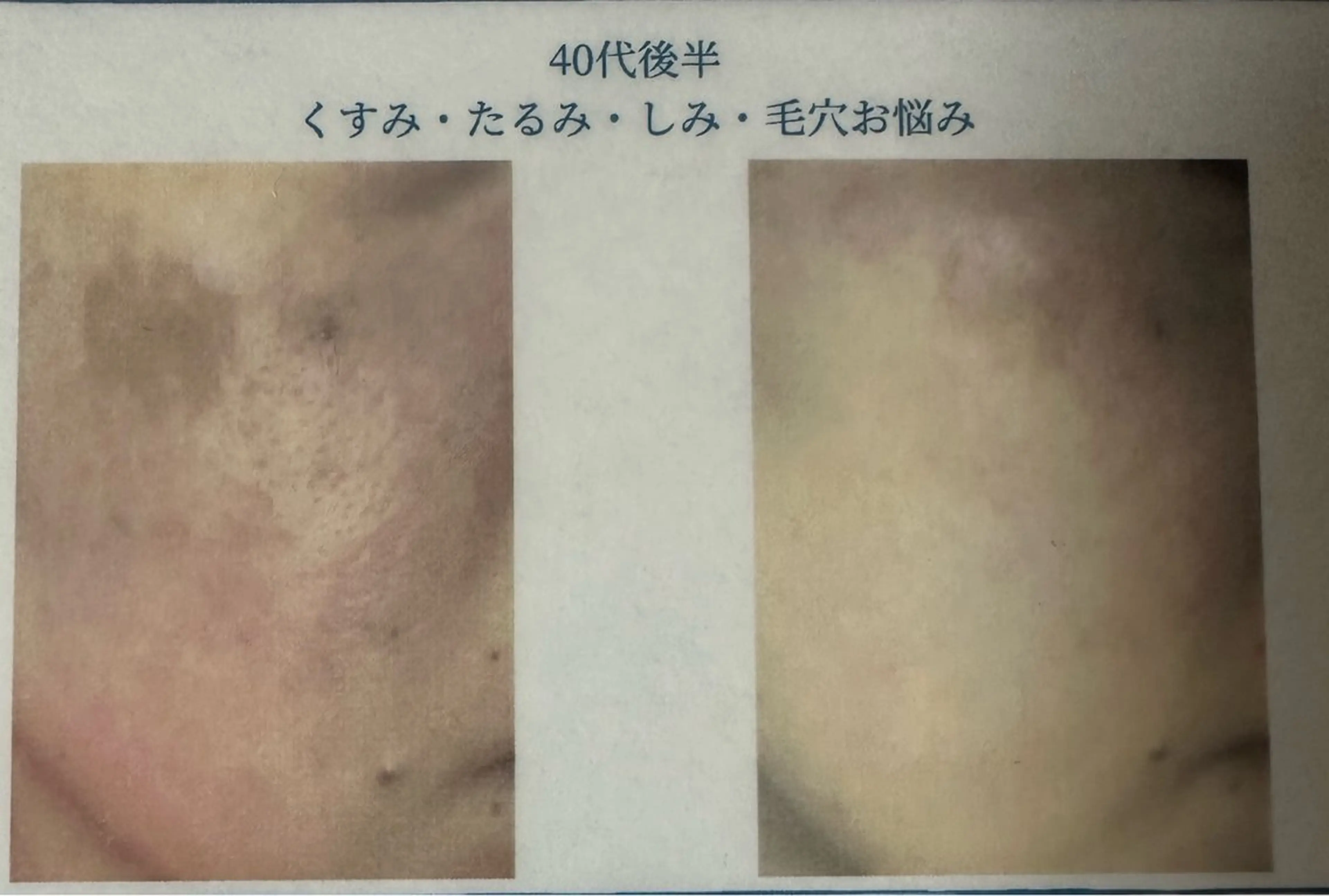 ボディケアサロン R ioNのエステ・リラクイメージ