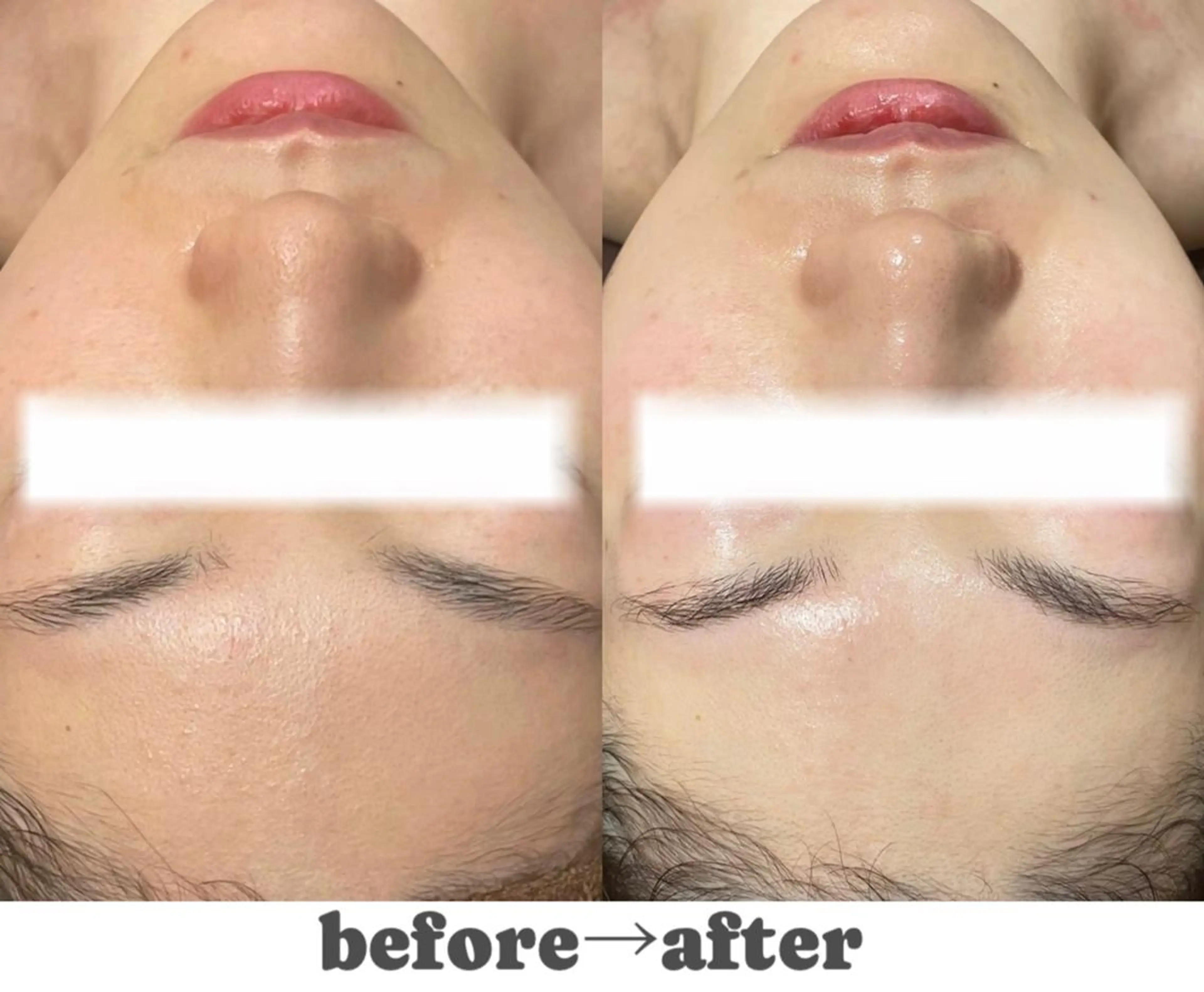 エステ リラク 🌷毛穴エステ レイビスMURA🌷のエステ・リラクイメージ