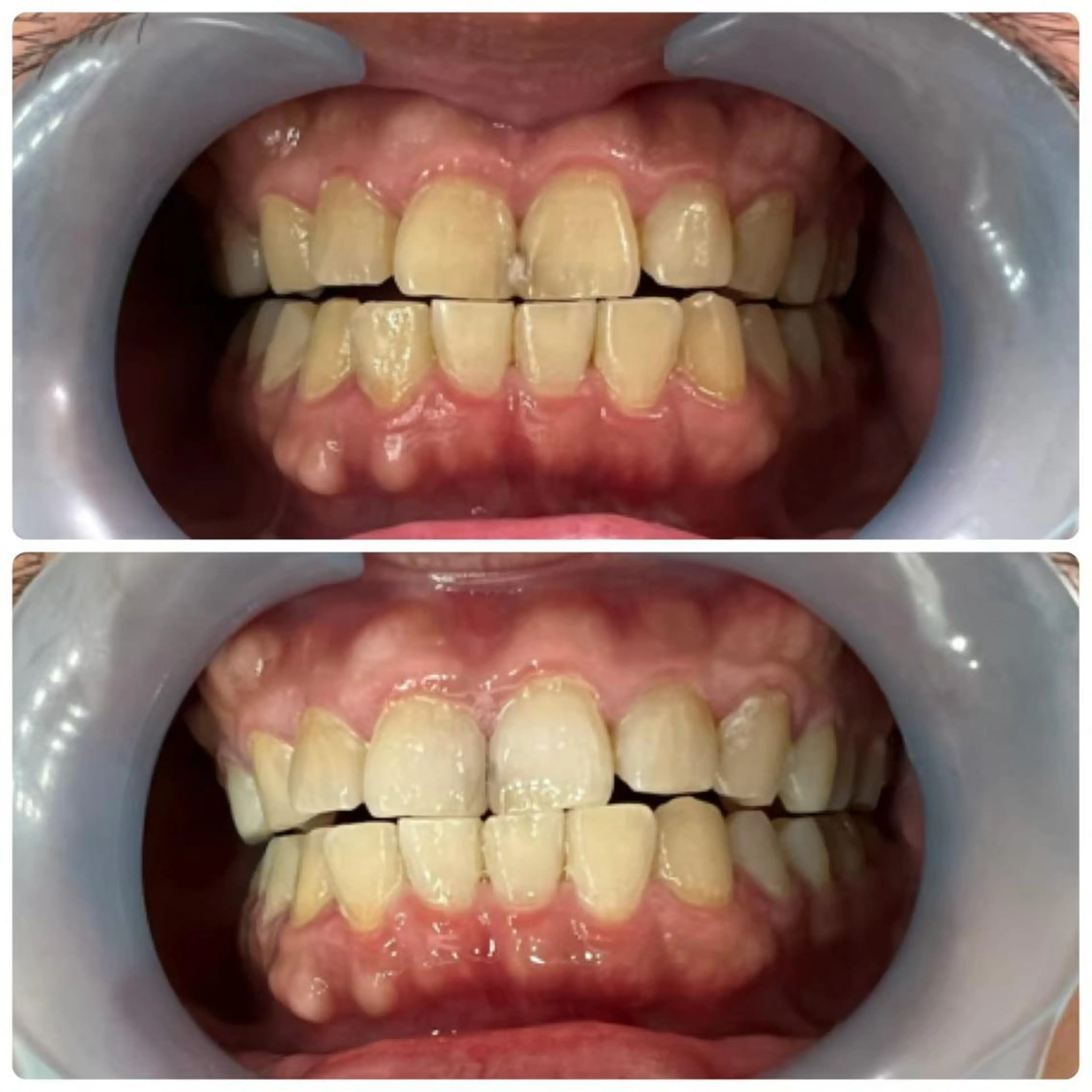 メンズ LOVEホワイト ニング恵比寿店のその他イメージ