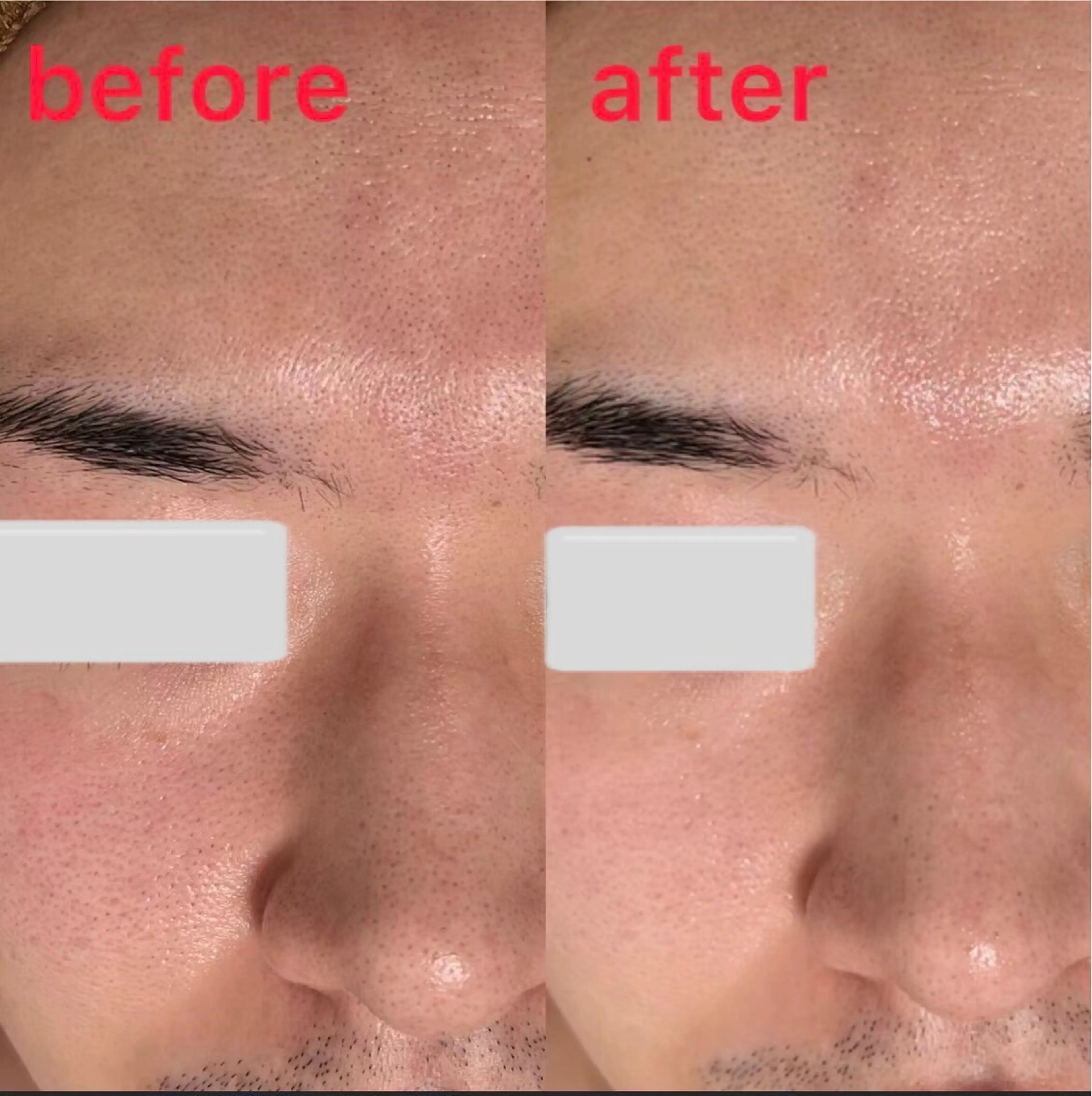 エステ 肌質改善サロン La Divinaのエステ・リラクイメージ