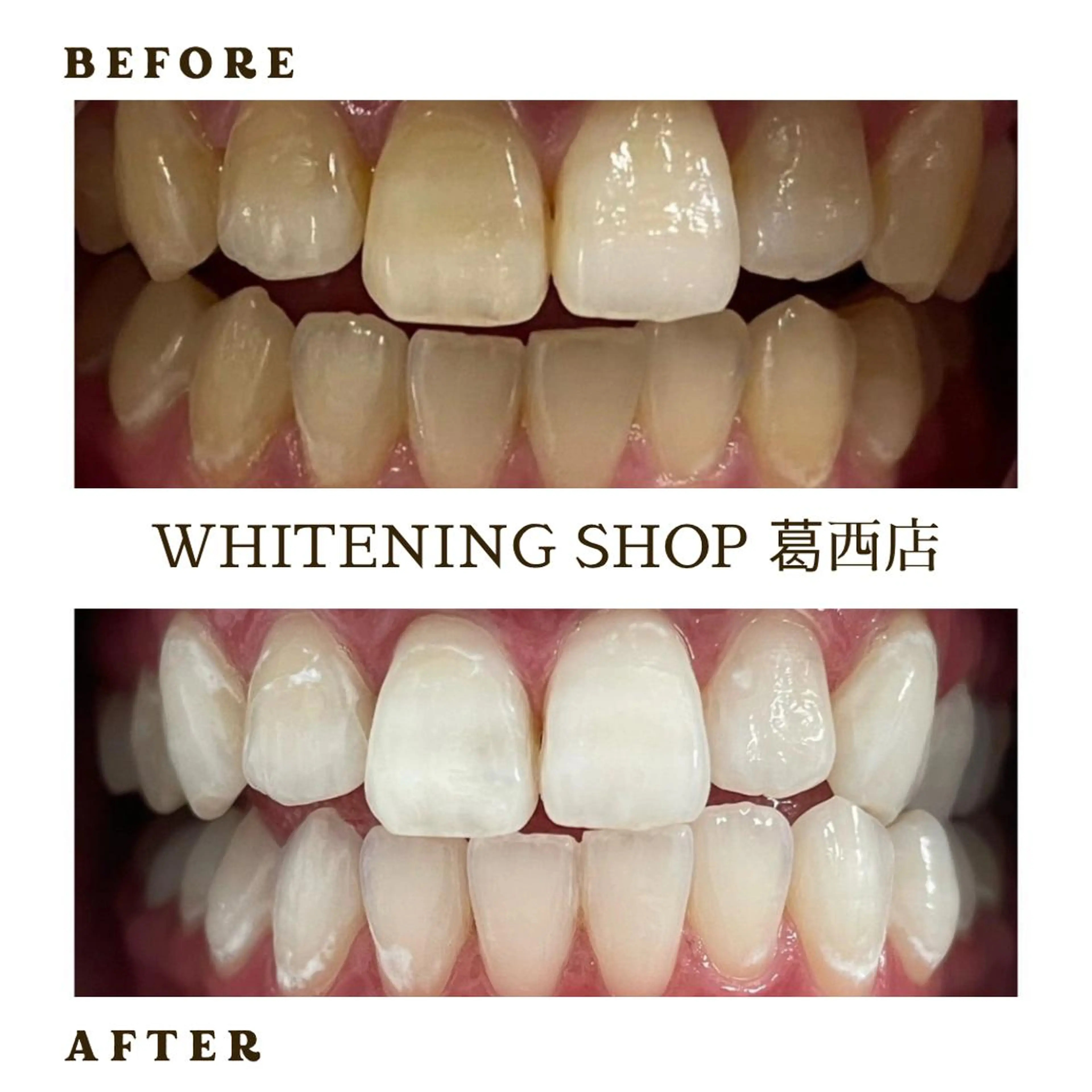 メンズ その他 ホワイトニング ショップ葛西店のその他イメージ