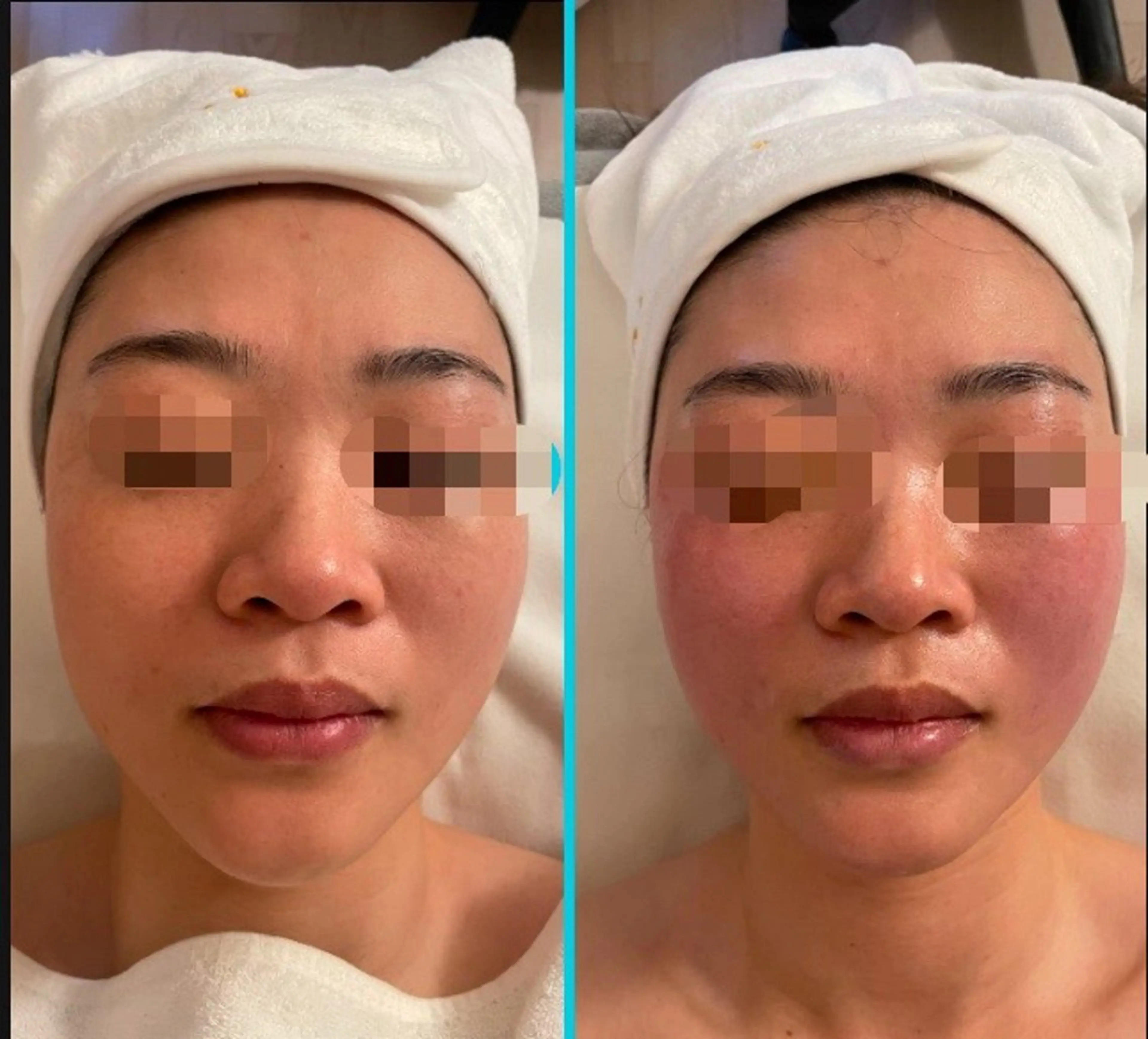 エステ M 🌱naturalのエステ・リラクイメージ