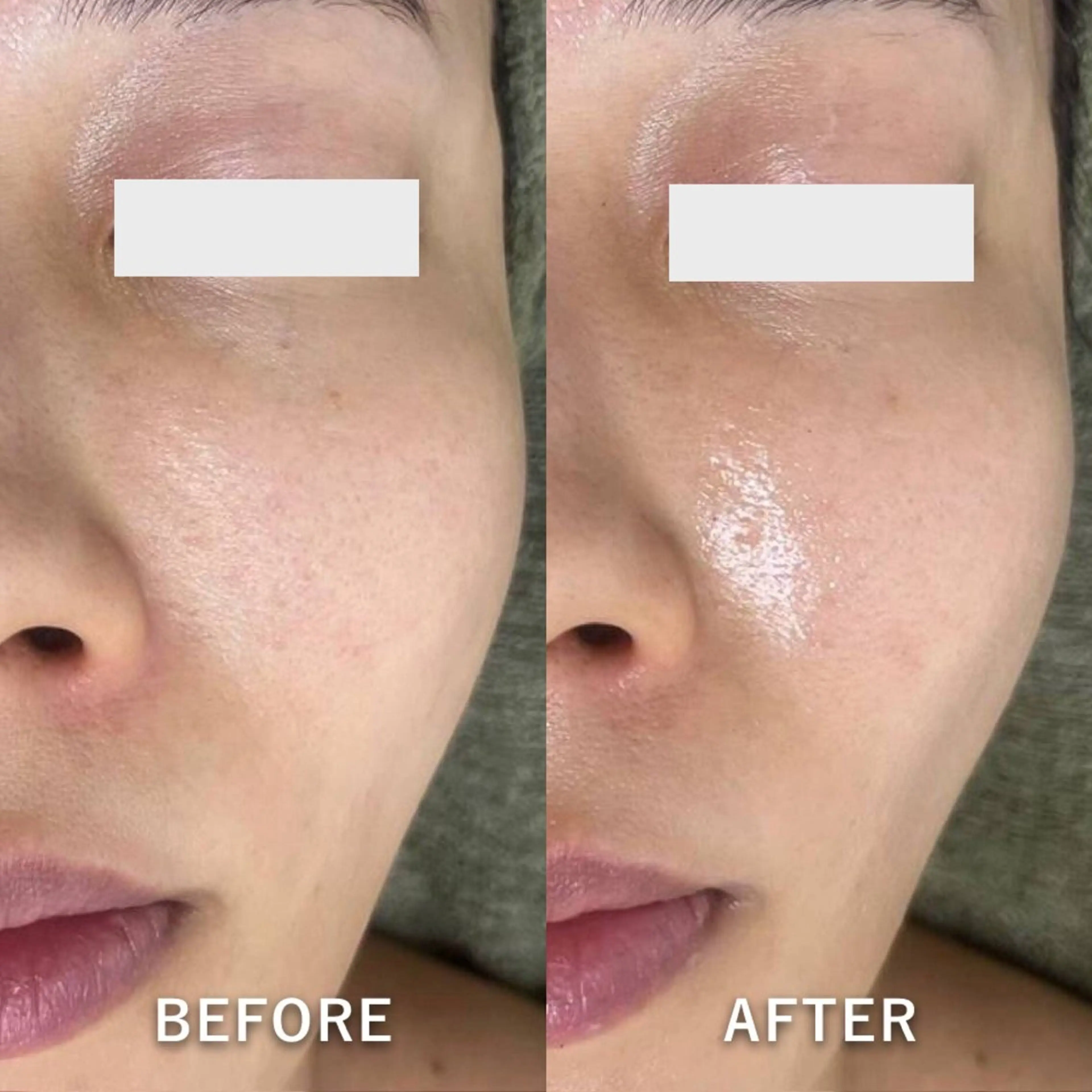 エステ 韓国美肌/肌質改善 【天神】のエステ・リラクイメージ