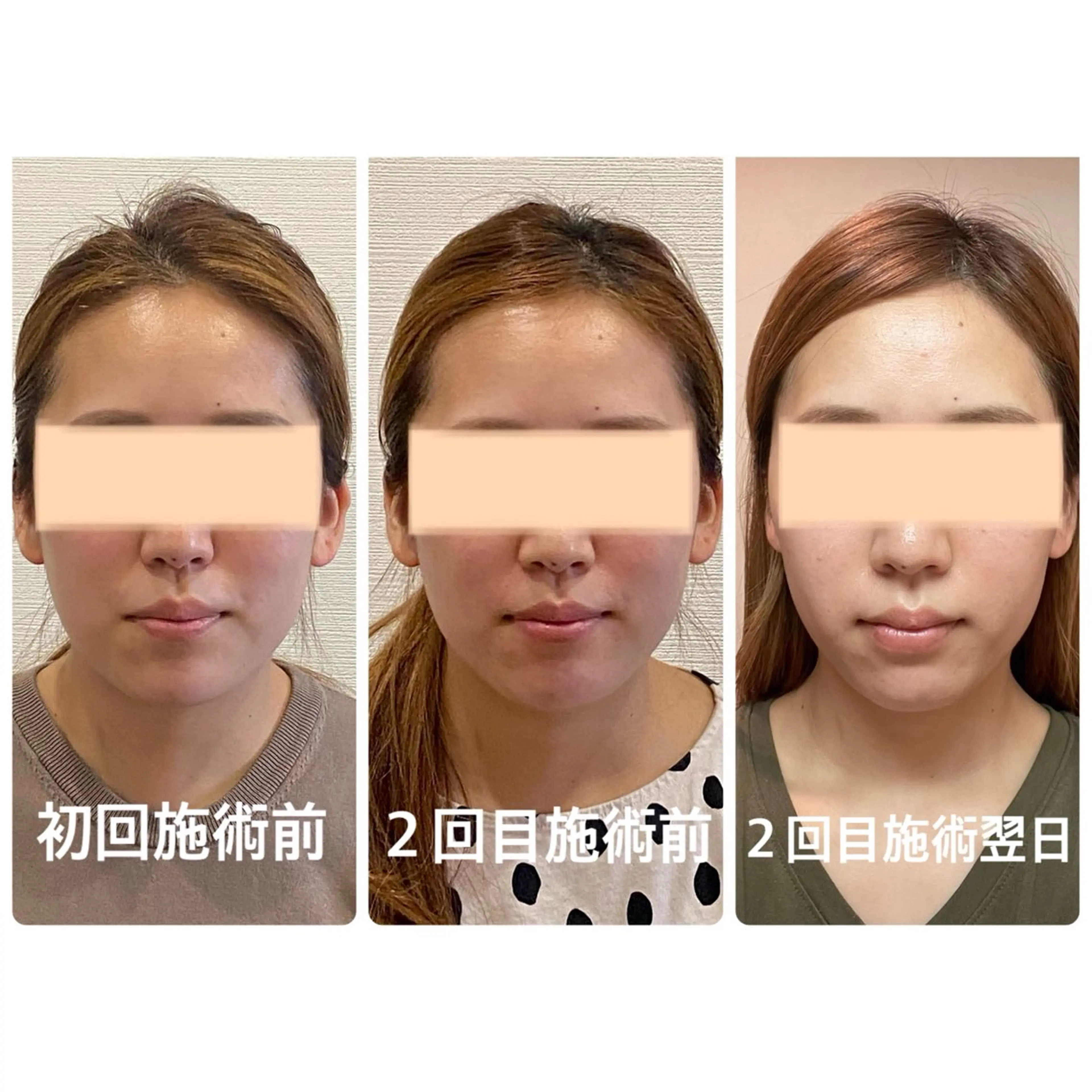 Cream 福井のエステ・リラクイメージ