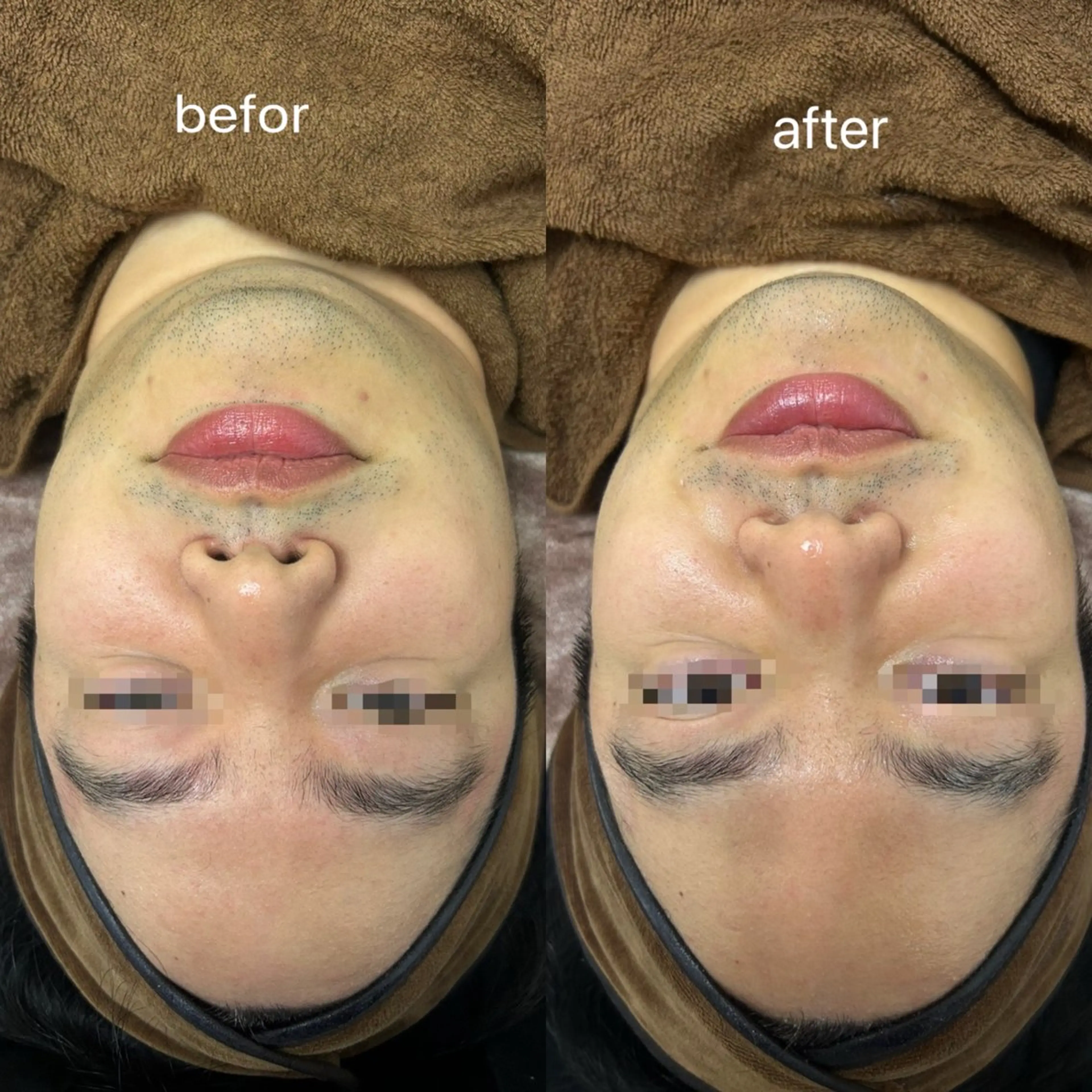 メンズ エステ 看護師が施術する小顔 サロン/KIKIのエステ・リラクイメージ