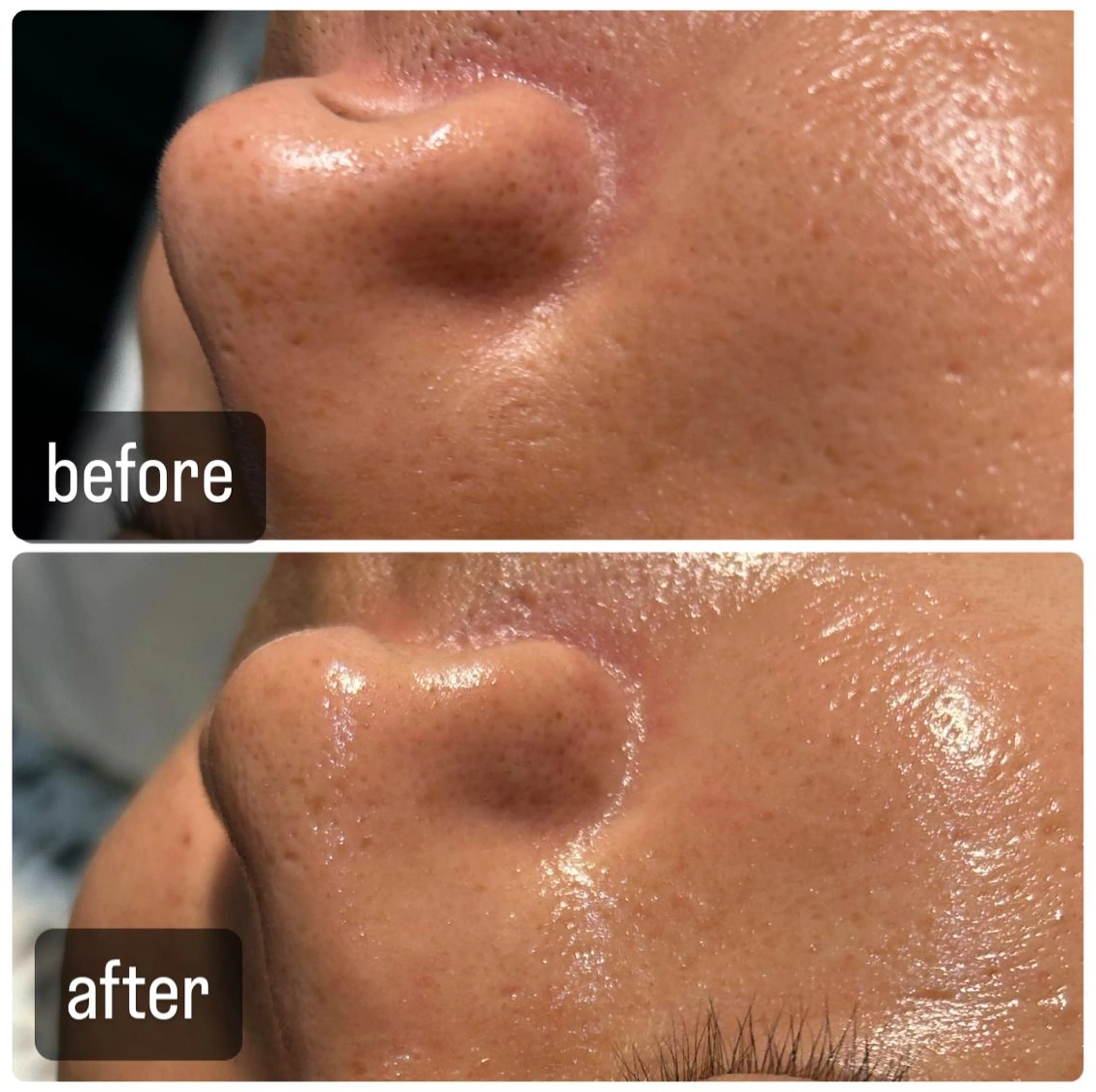 エステ Gemini 　MIKIのエステ・リラクイメージ