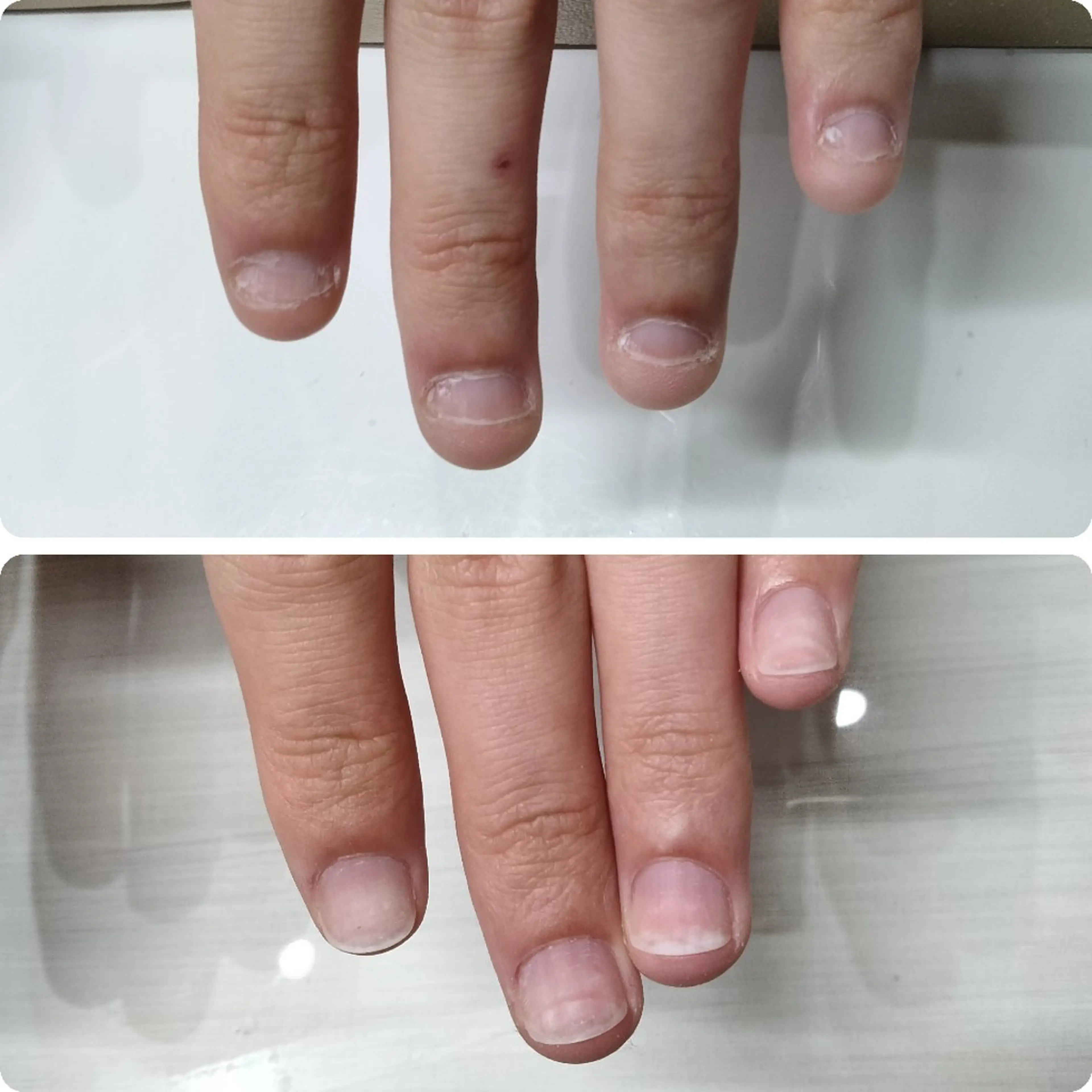 ネイル ネイルサロン アリュームのネイルデザイン