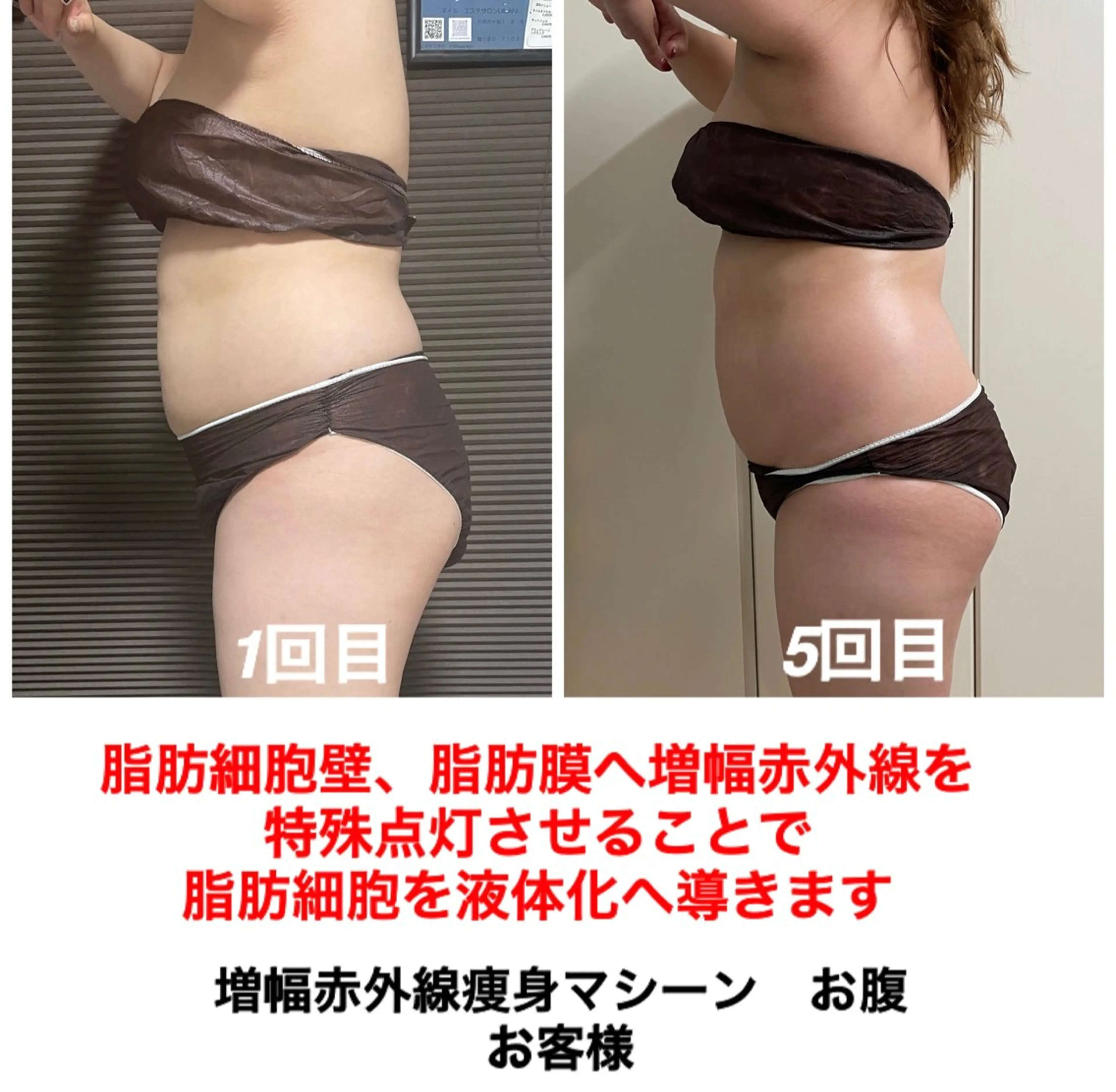 エステ ネイル・エステサロン UILANIのネイルデザイン