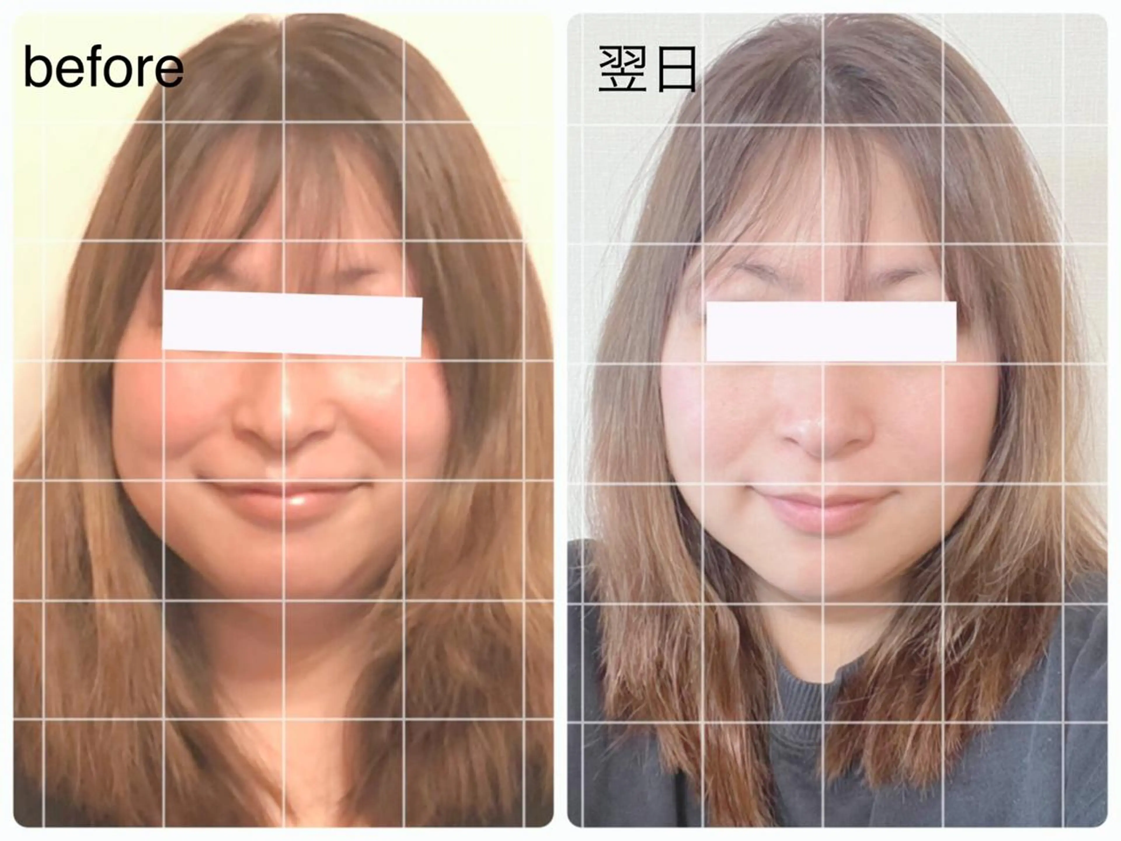 エステ リラク 小顔矯正ドライヘッド Arincoのエステ・リラクイメージ