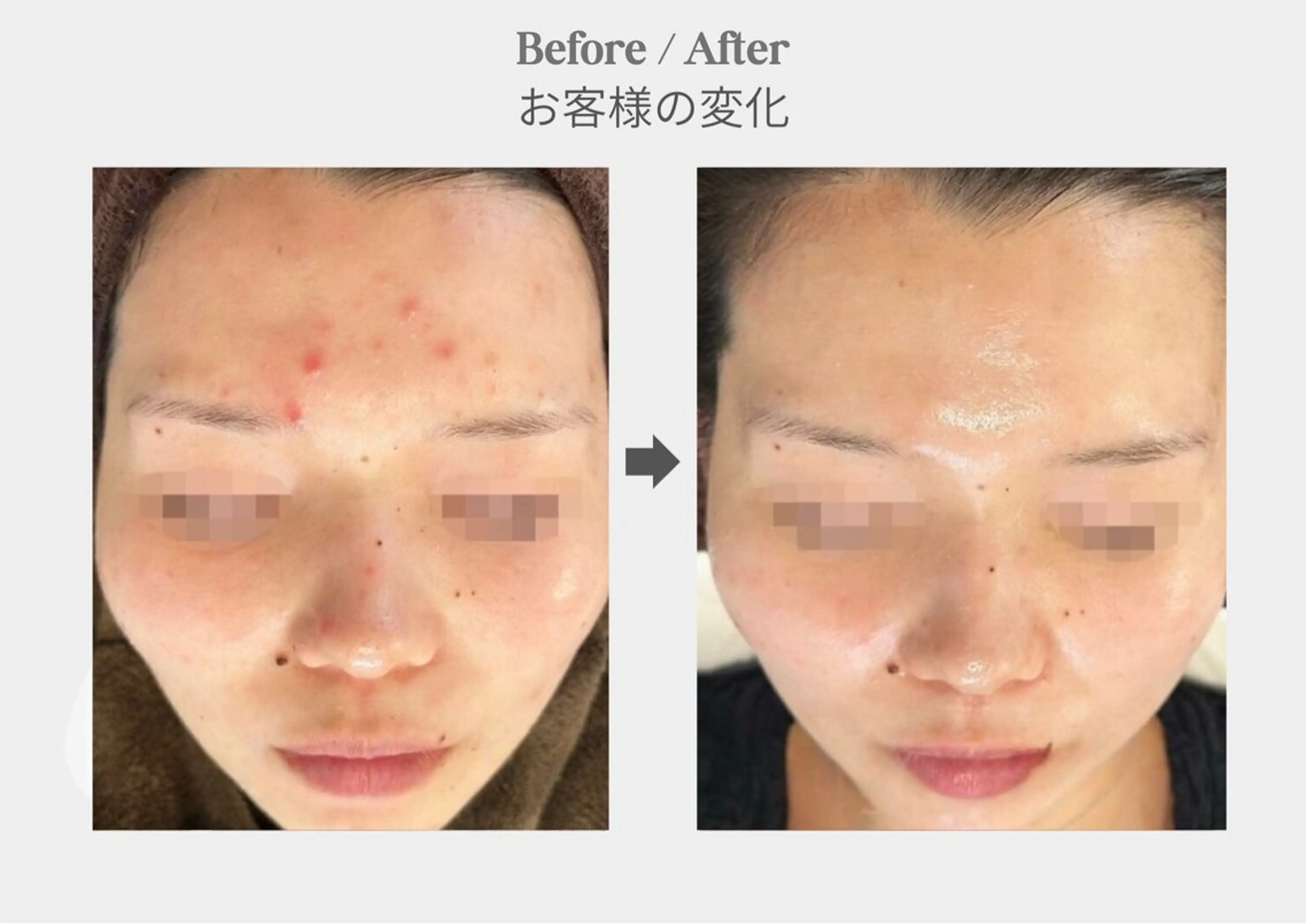 エステ 店長 RUNAのエステ・リラクイメージ