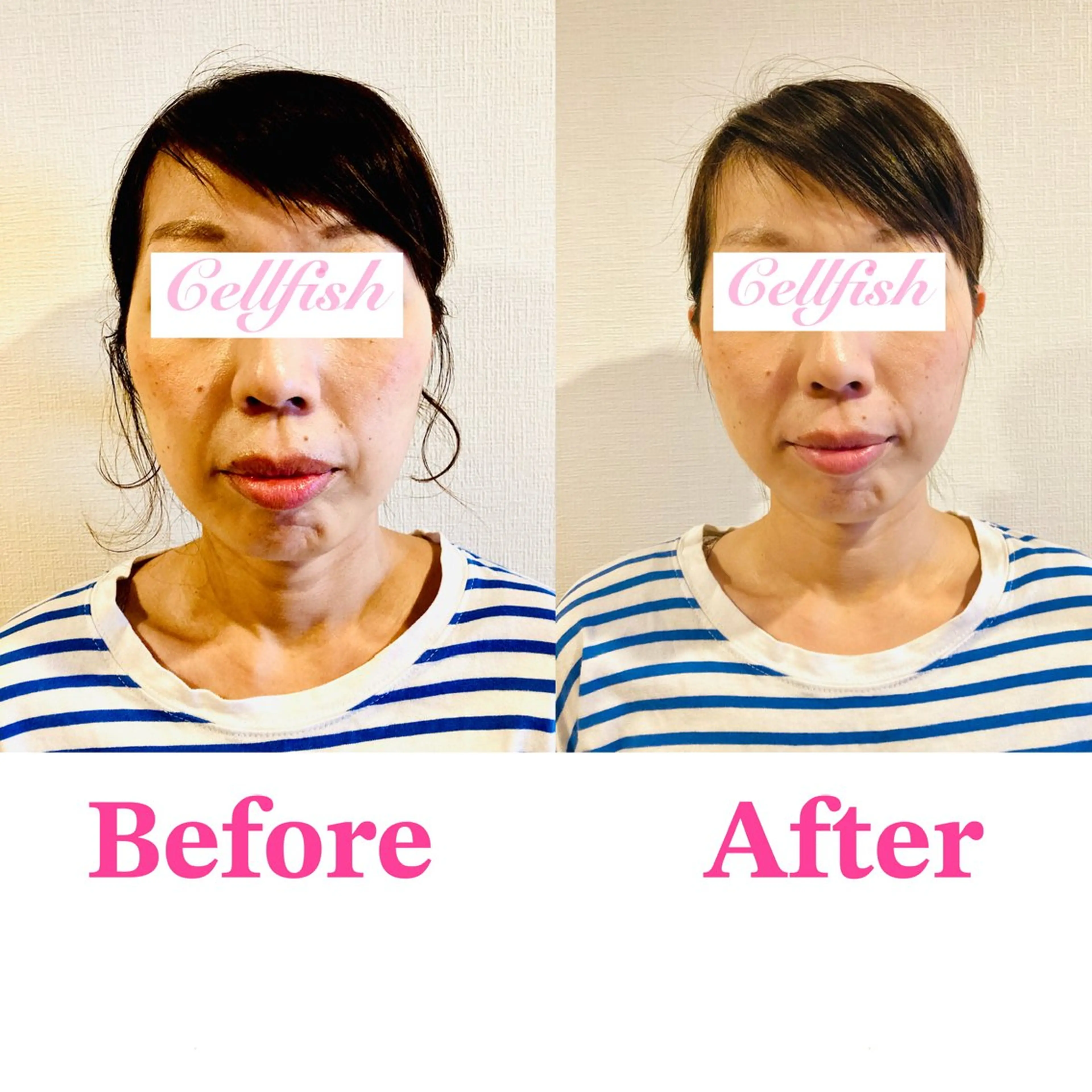 【小顔矯正✖️全身矯正】高い技術の美容整骨で、小顔/美姿勢/肩こり/ストレートネック/首こり◎❣️の写真