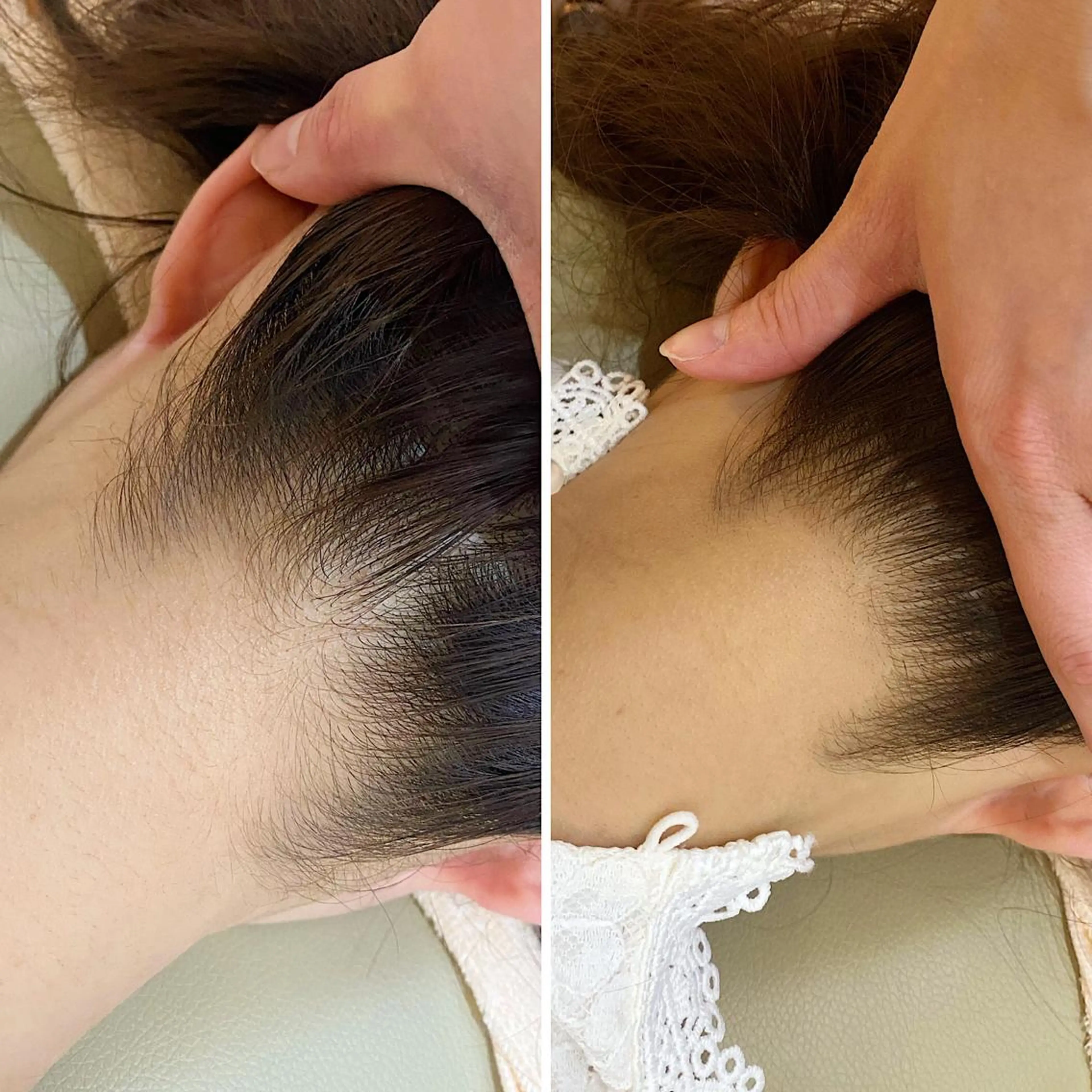 脱毛 うなじ脱毛/美肌脱毛 LABELのエステ・リラクイメージ