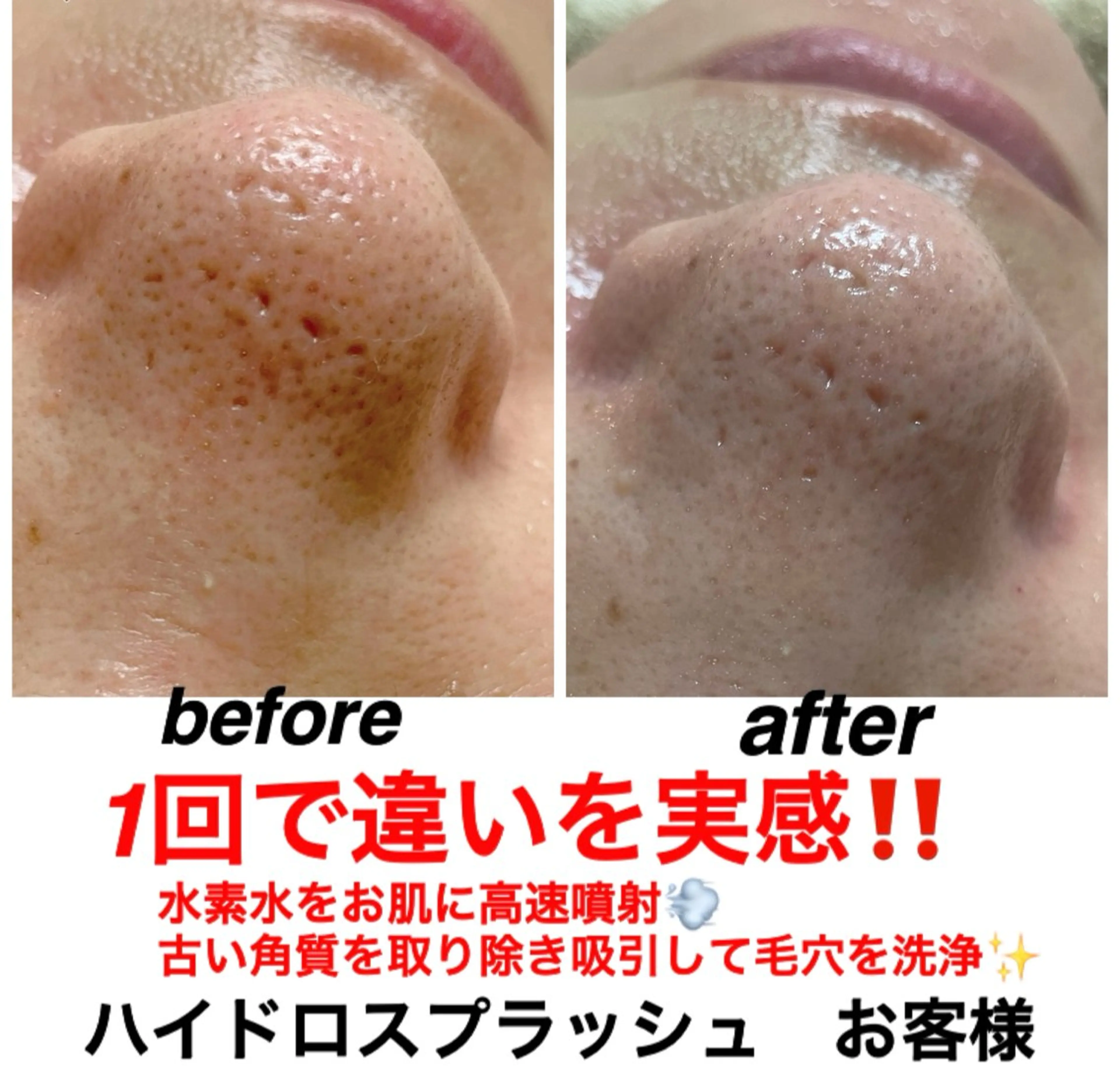 エステ リラク ネイル・エステサロン UILANIのネイルデザイン