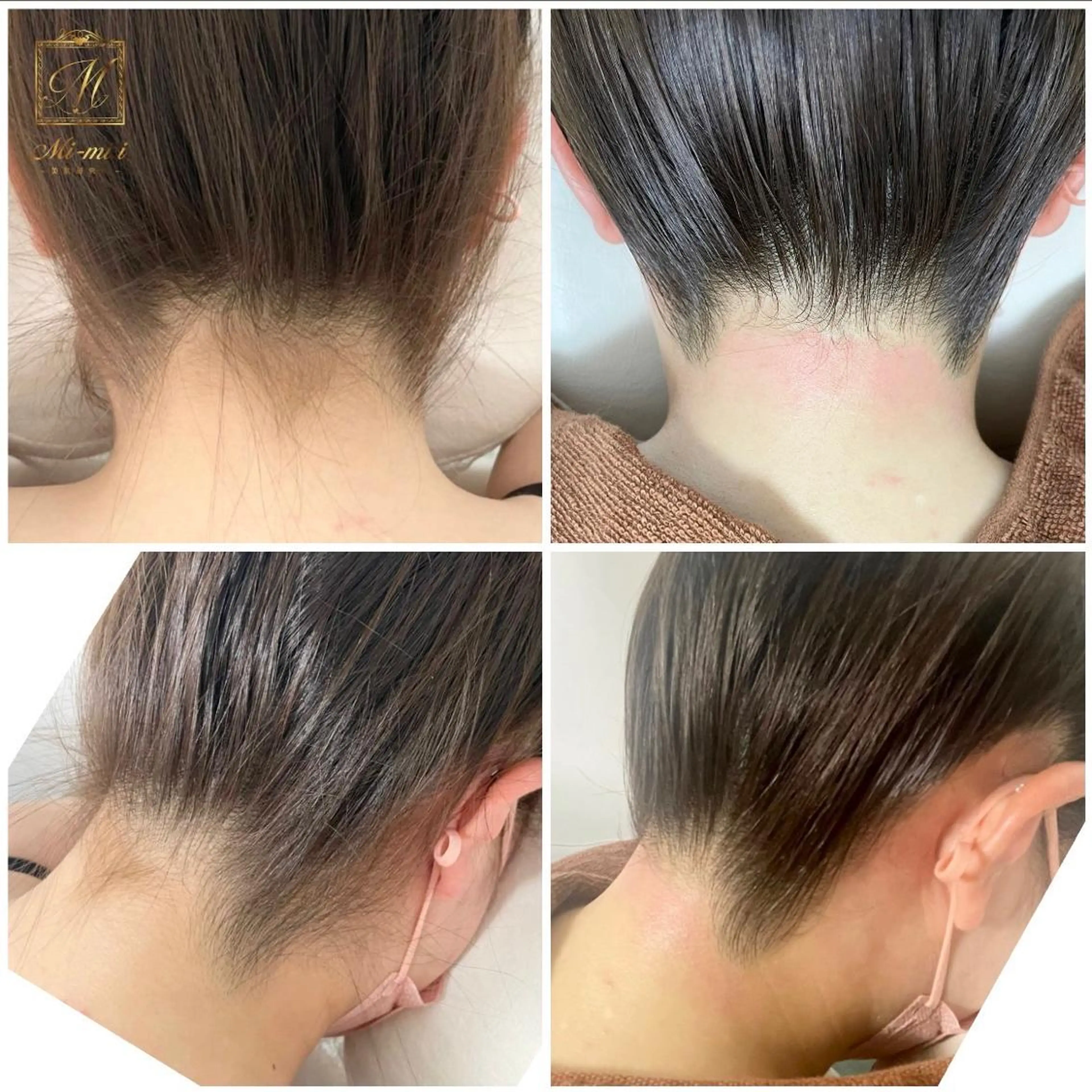 脱毛 エステサロン Mi-mi.iのエステ・リラクイメージ