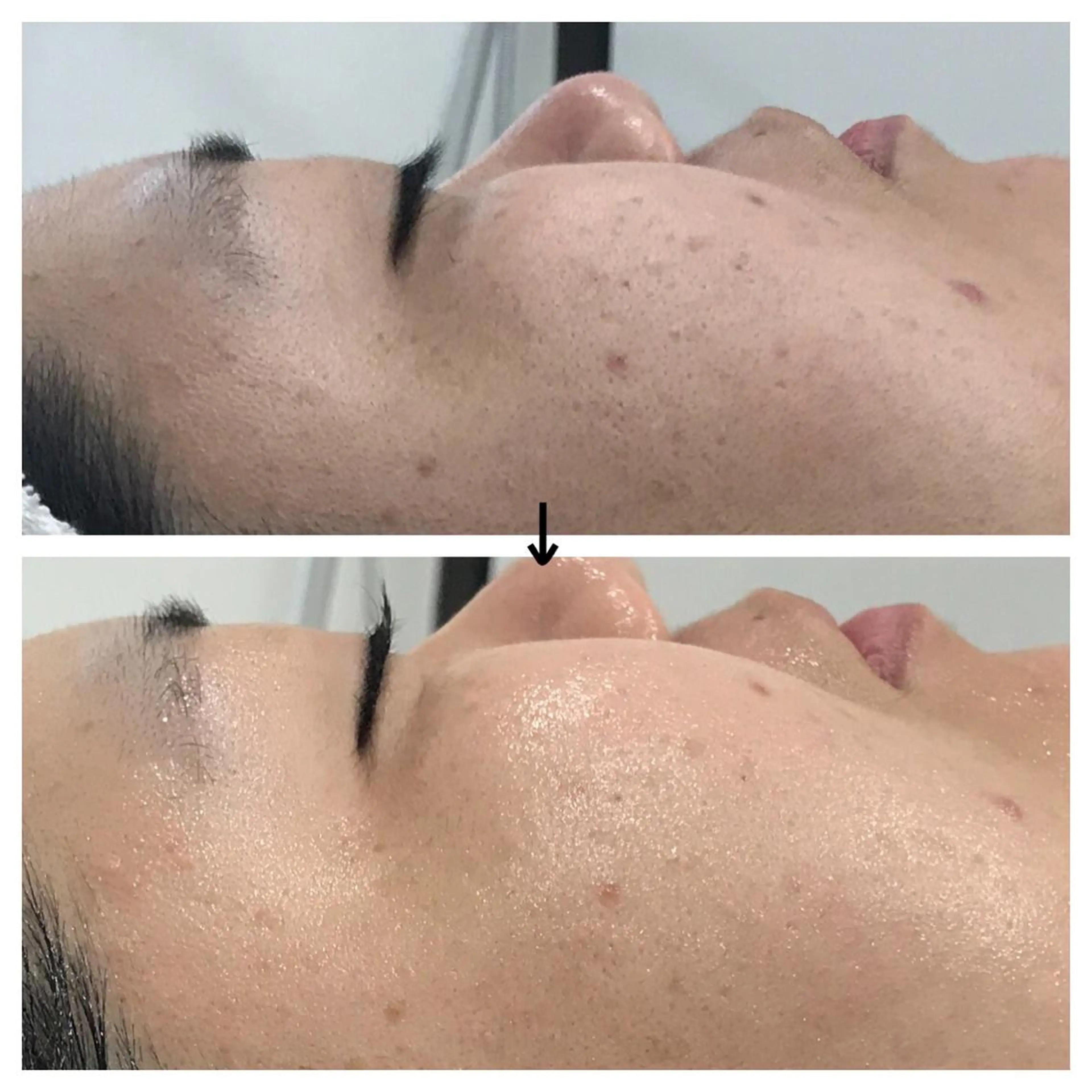 ビューティー ミロワールのエステ・リラクイメージ