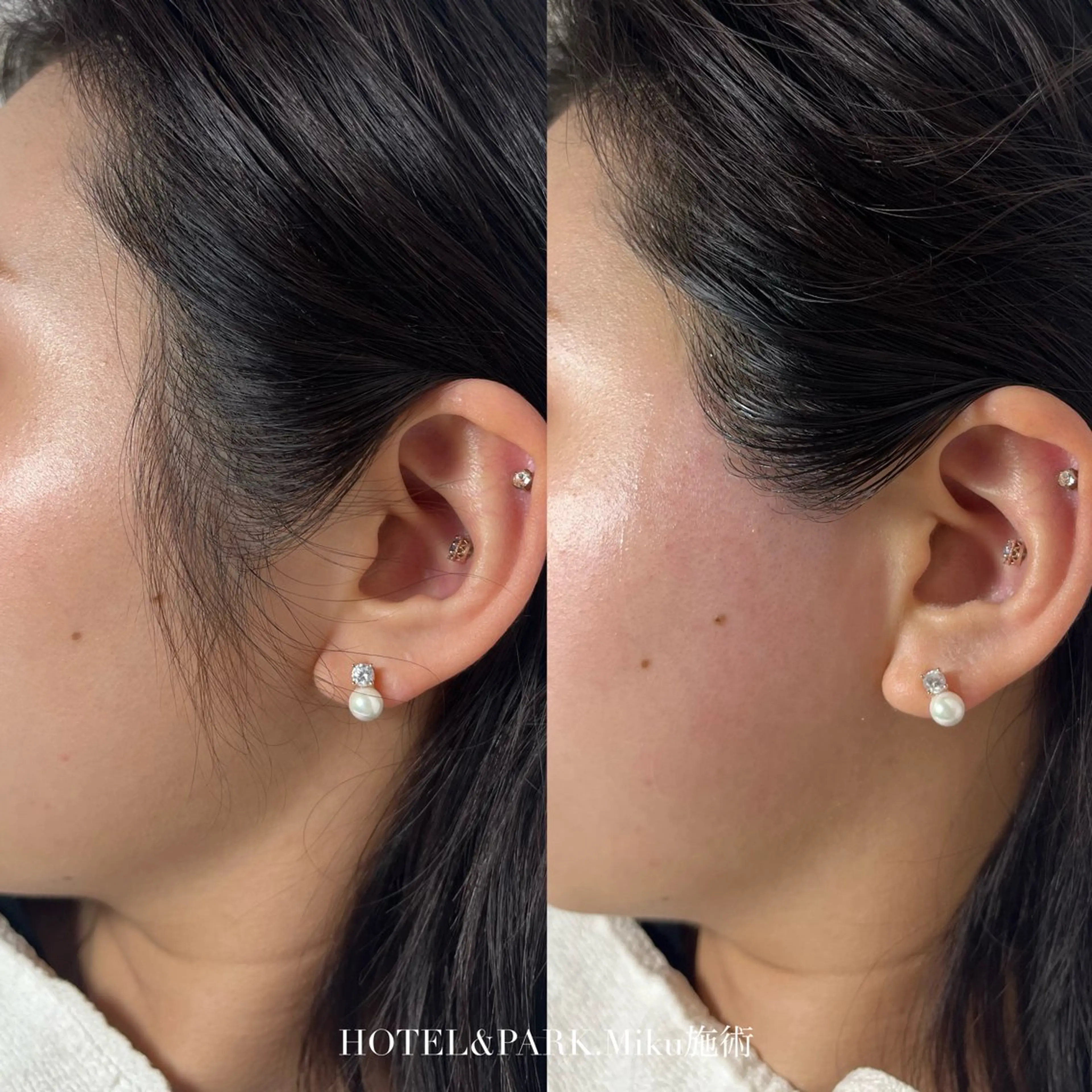 脱毛 HOTEL&PARK Mikuワックス脱毛のエステ・リラクイメージ