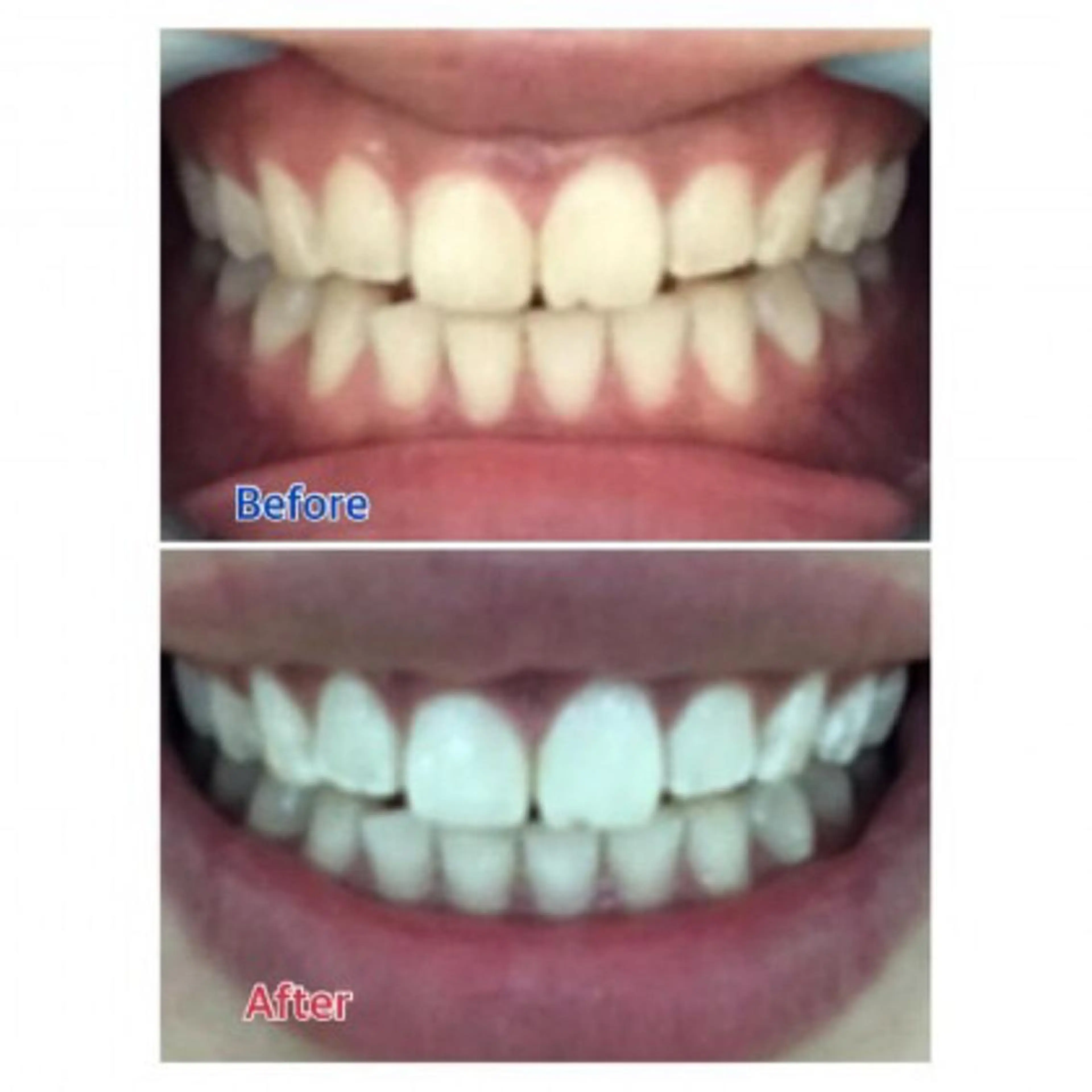 Ｍ渋谷 ホワイトニングのエステ・リラクイメージ