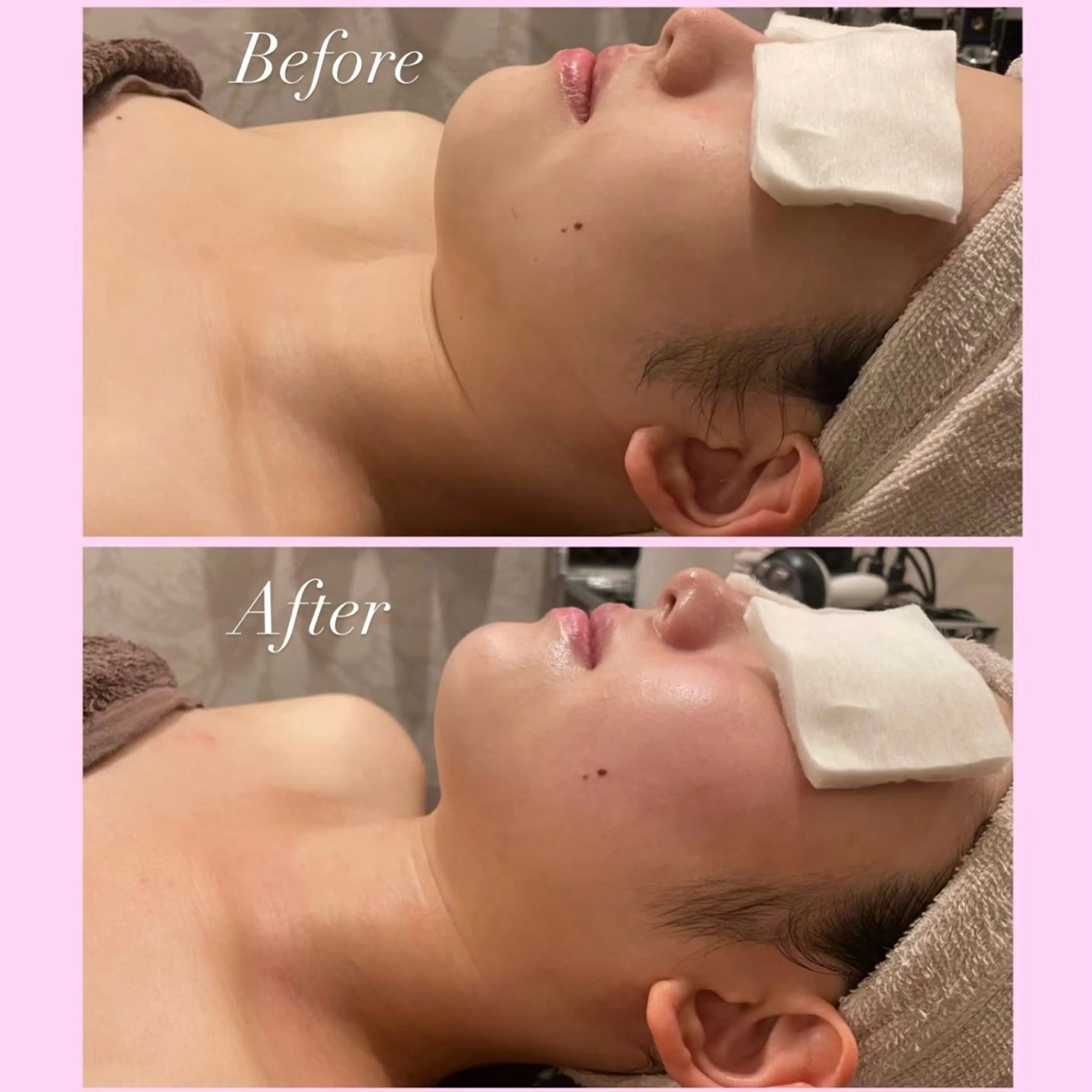 エステ リラク Tulipe Chihoのエステ・リラクイメージ