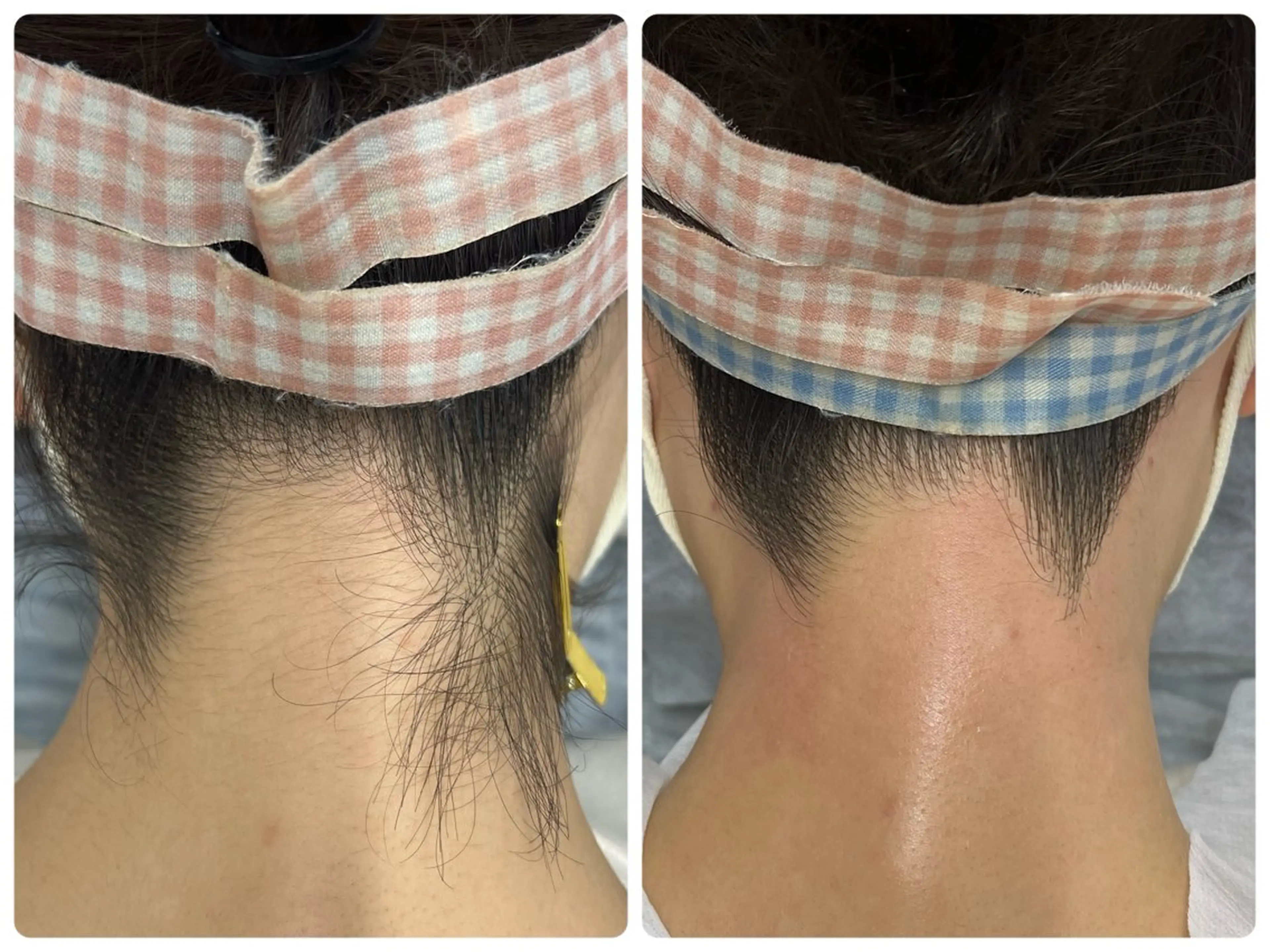 🌼SALON Lazuli久留米のエステ・リラクイメージ