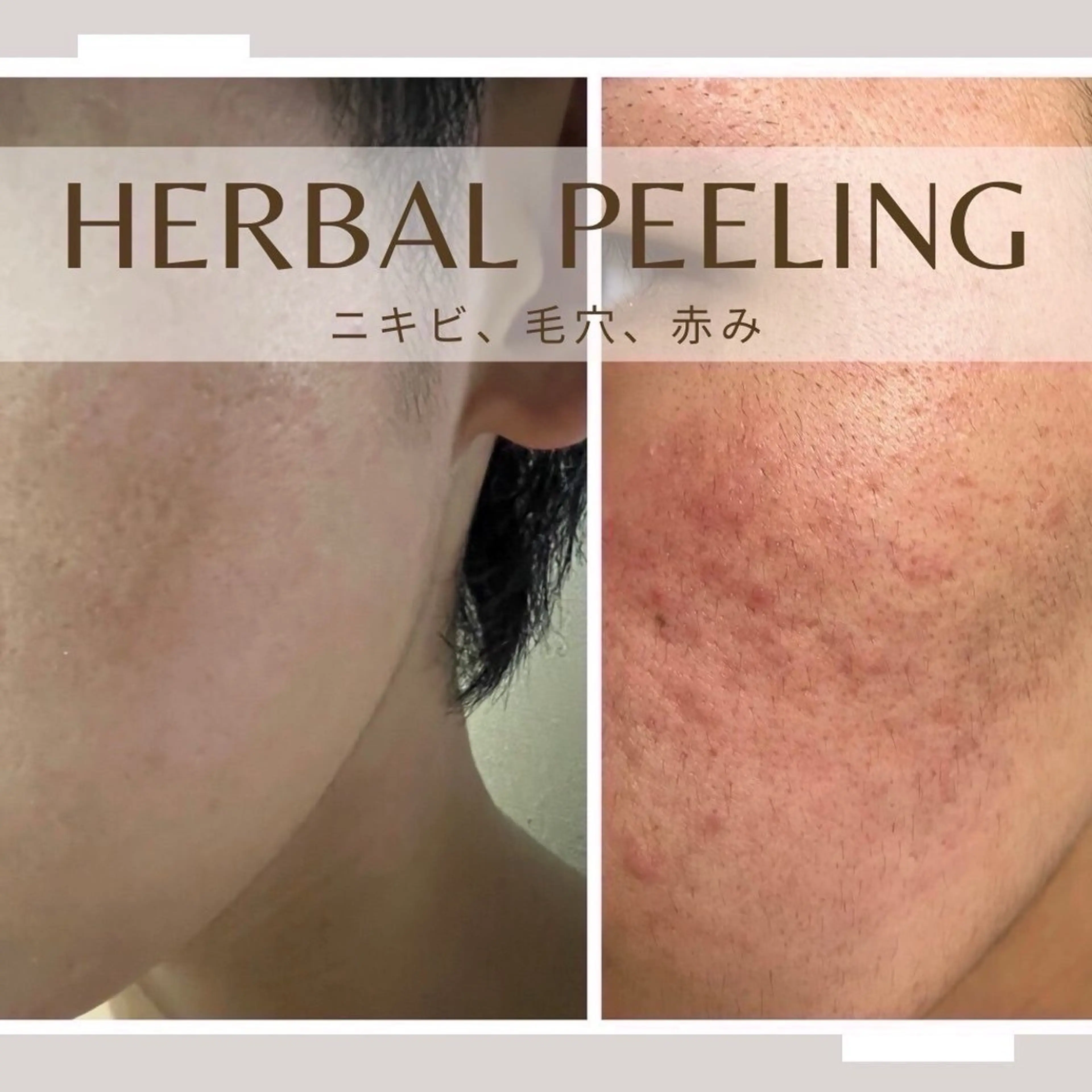 エステ ECXIA 【エクシア】のエステ・リラクイメージ