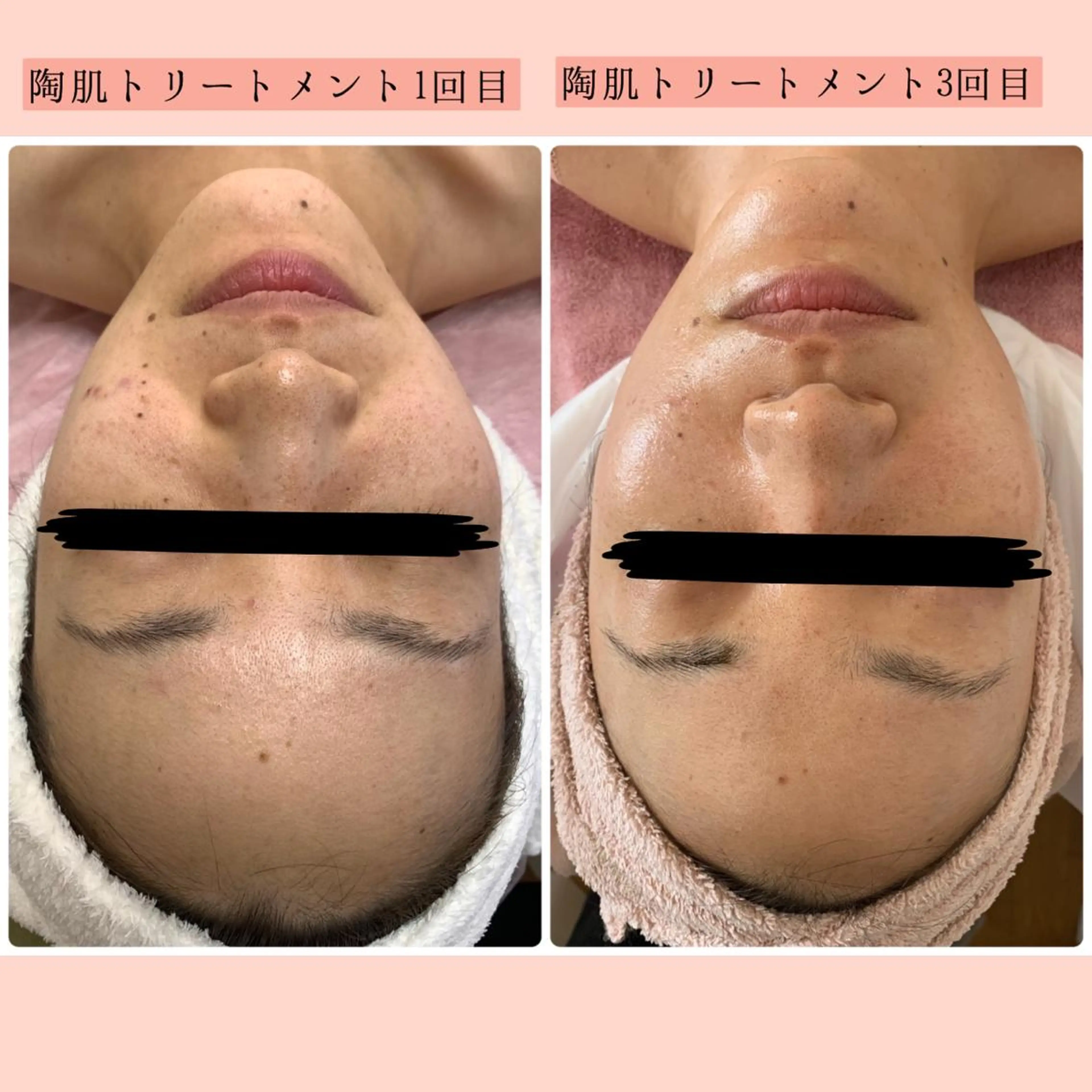 堀井 舞琳のエステ・リラクイメージ