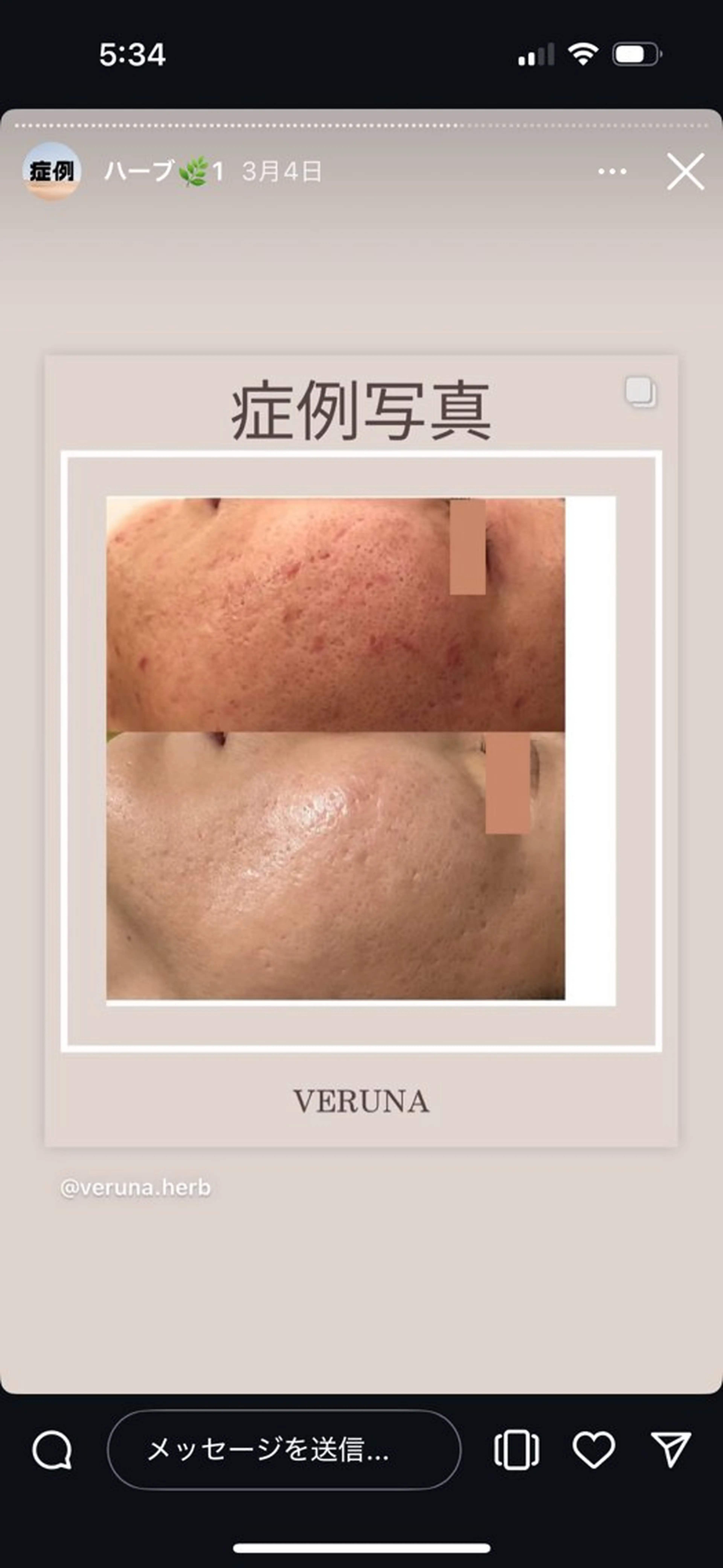 キッズ エステ リラク ハーブピーリング専門 グランディール　武内のエステ・リラクイメージ