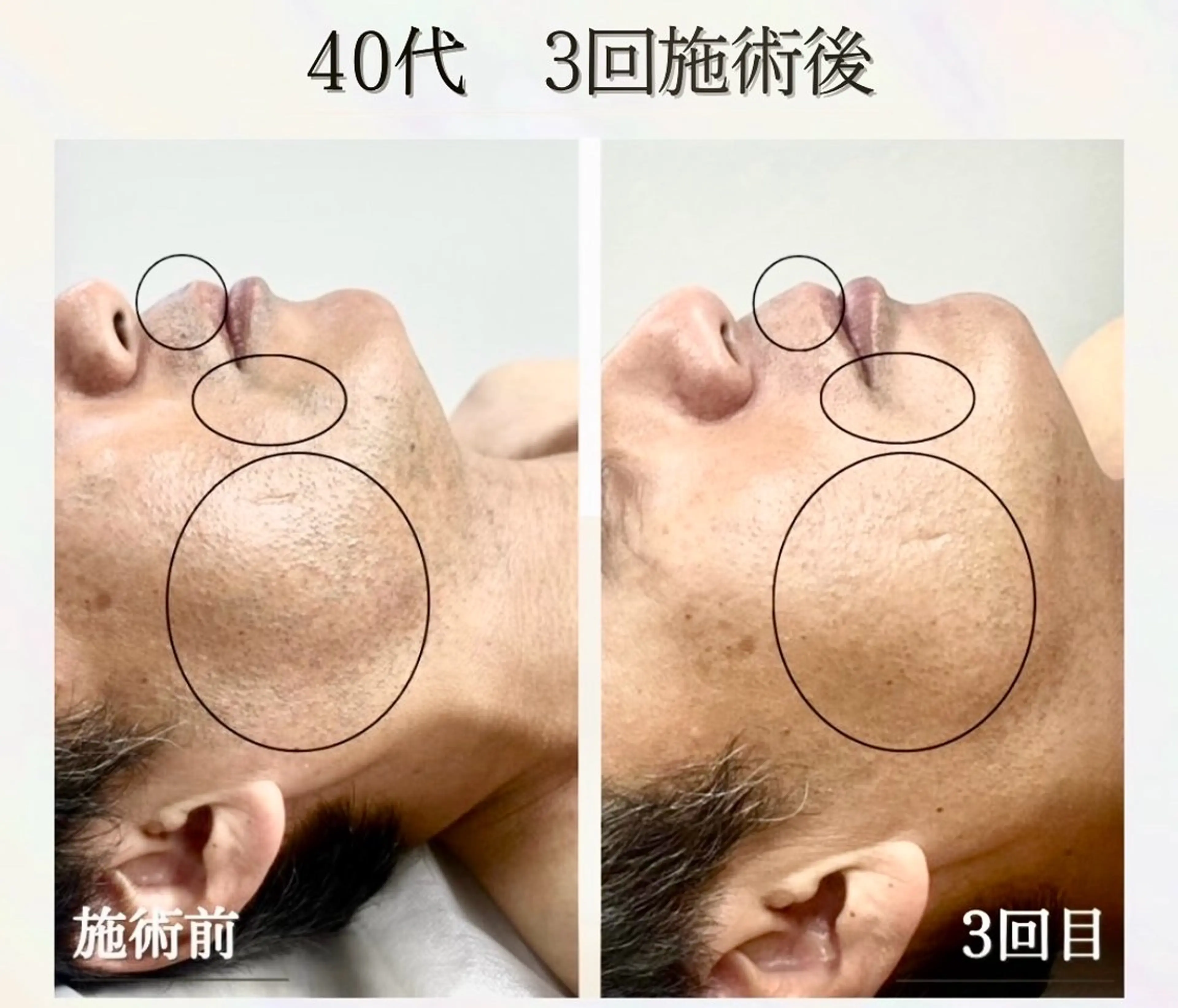 LED脱毛サロン【the 4】所属・元町駅1分 メンズ脱毛サロンのエステ・リラクイメージ