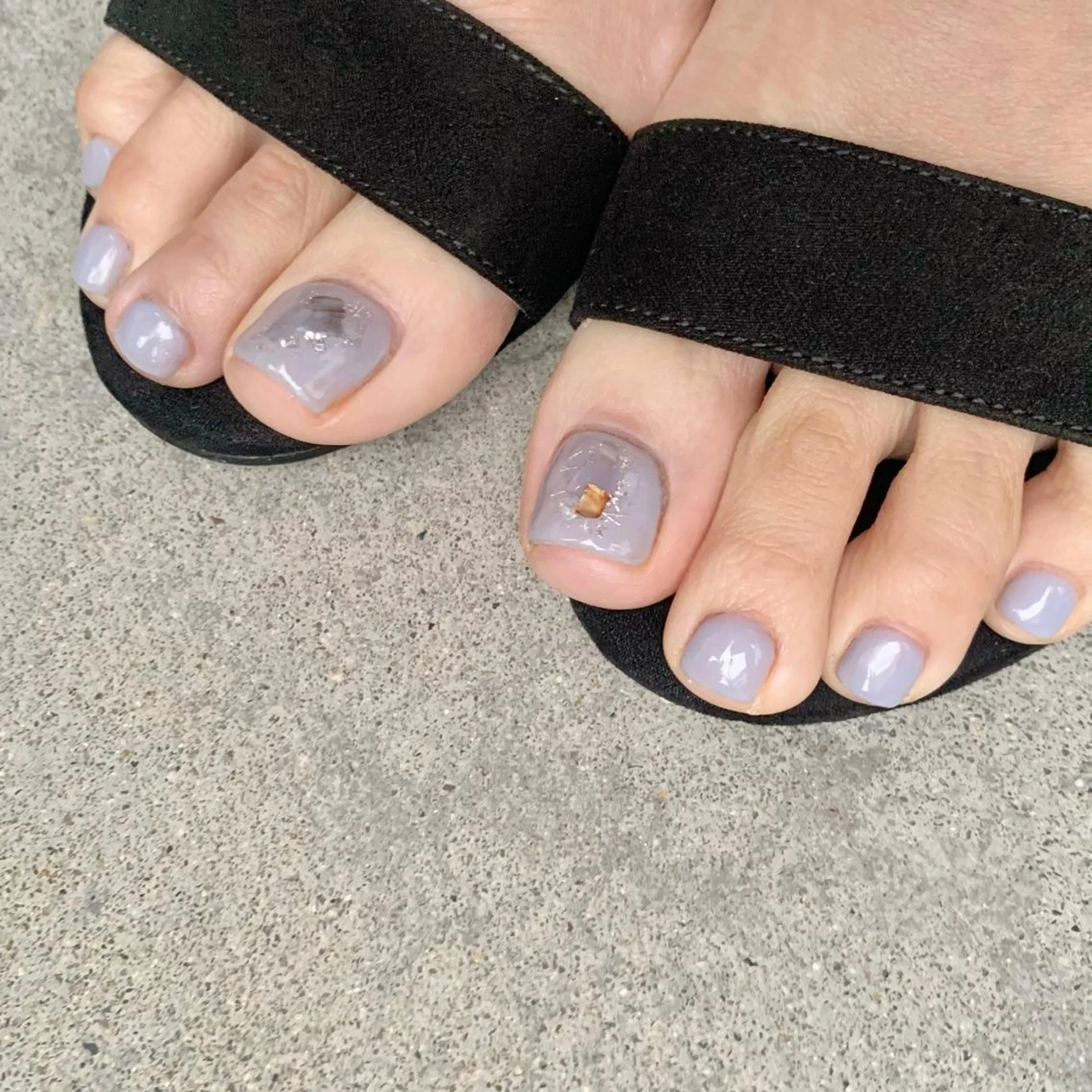 フットネイル♡親指2本アートの写真