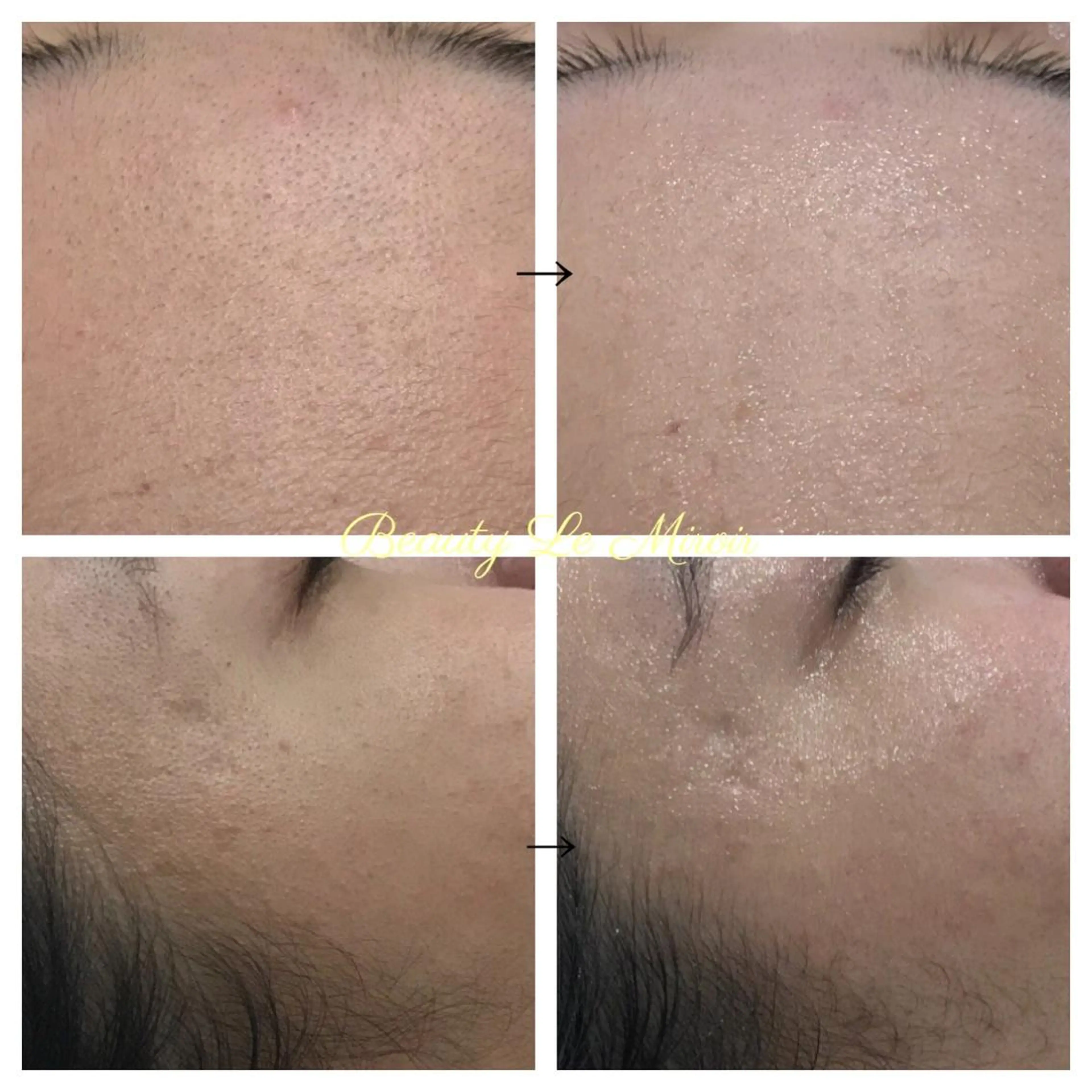 ビューティー ミロワールのエステ・リラクイメージ