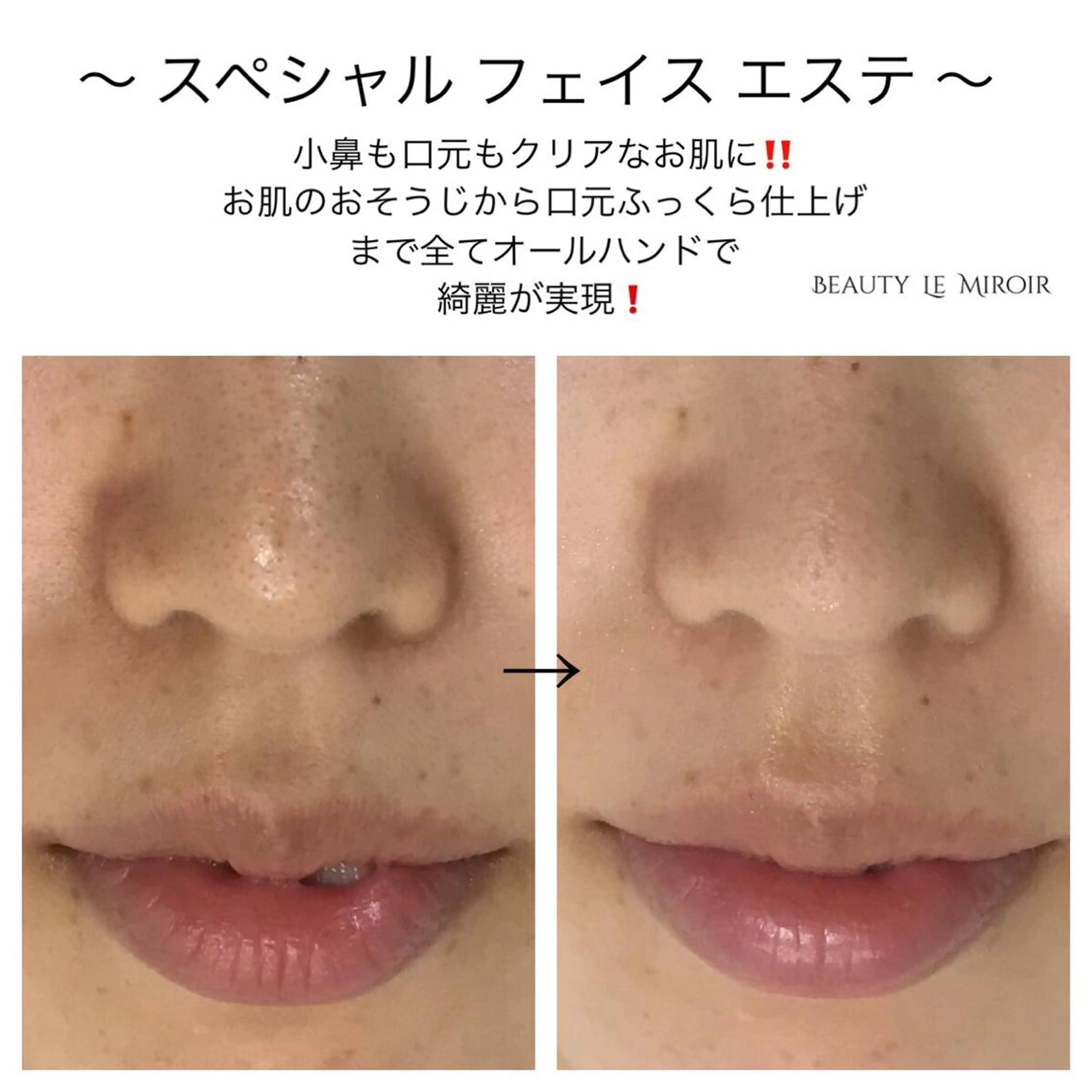 ビューティー ミロワールのエステ・リラクイメージ