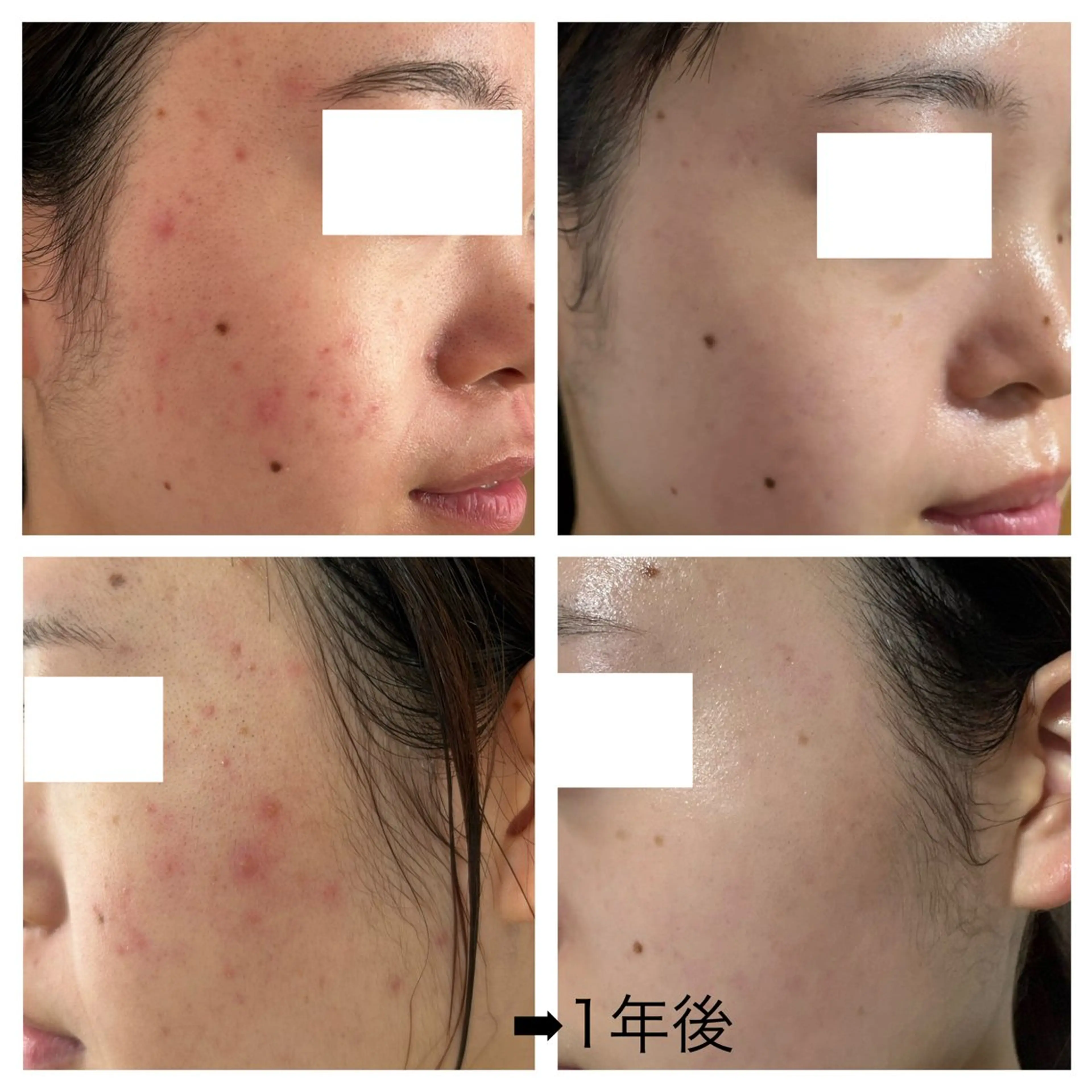 エステ 酒井 瑠未のエステ・リラクイメージ