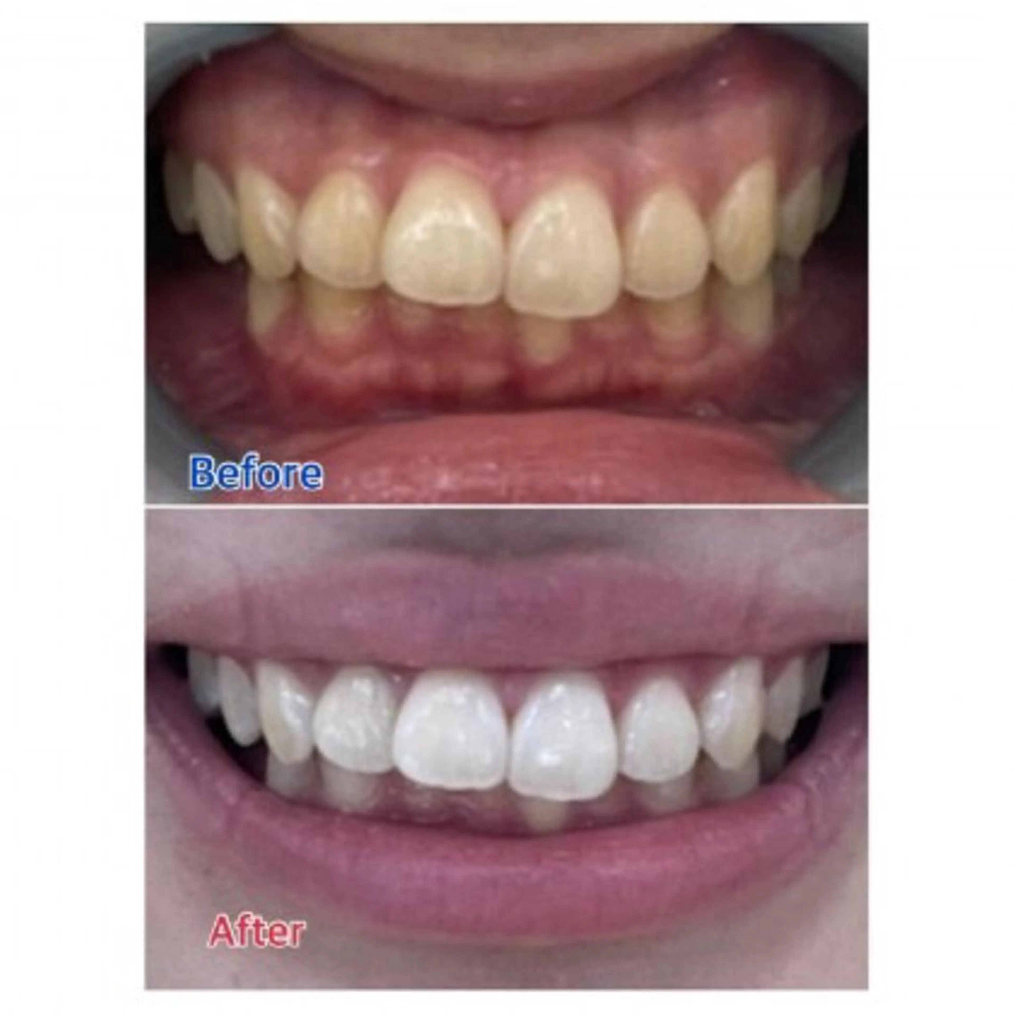 Ｍ渋谷 ホワイトニングのエステ・リラクイメージ