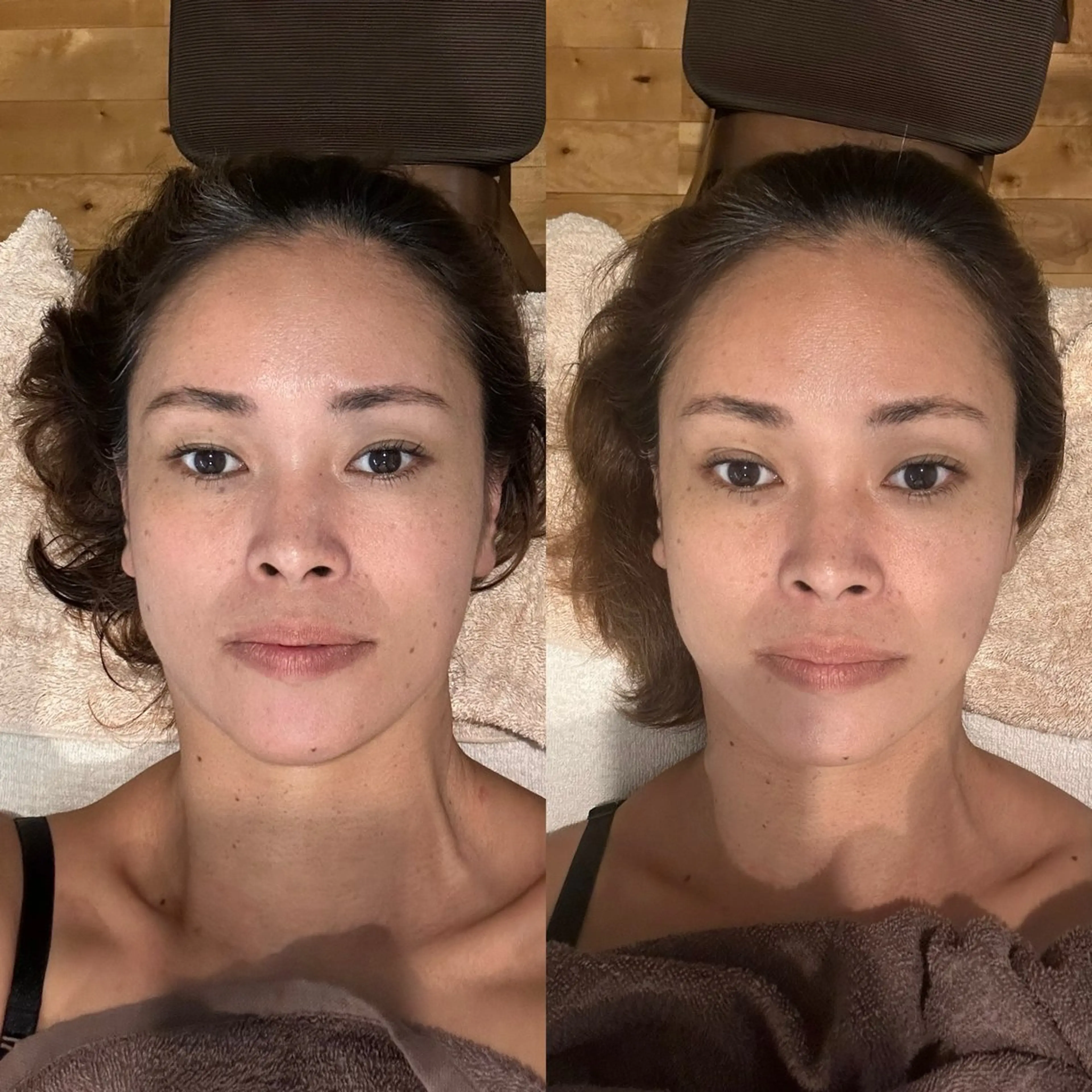 つるんとむき卵肌に 🌟ハーブピーリングのエステ・リラクイメージ