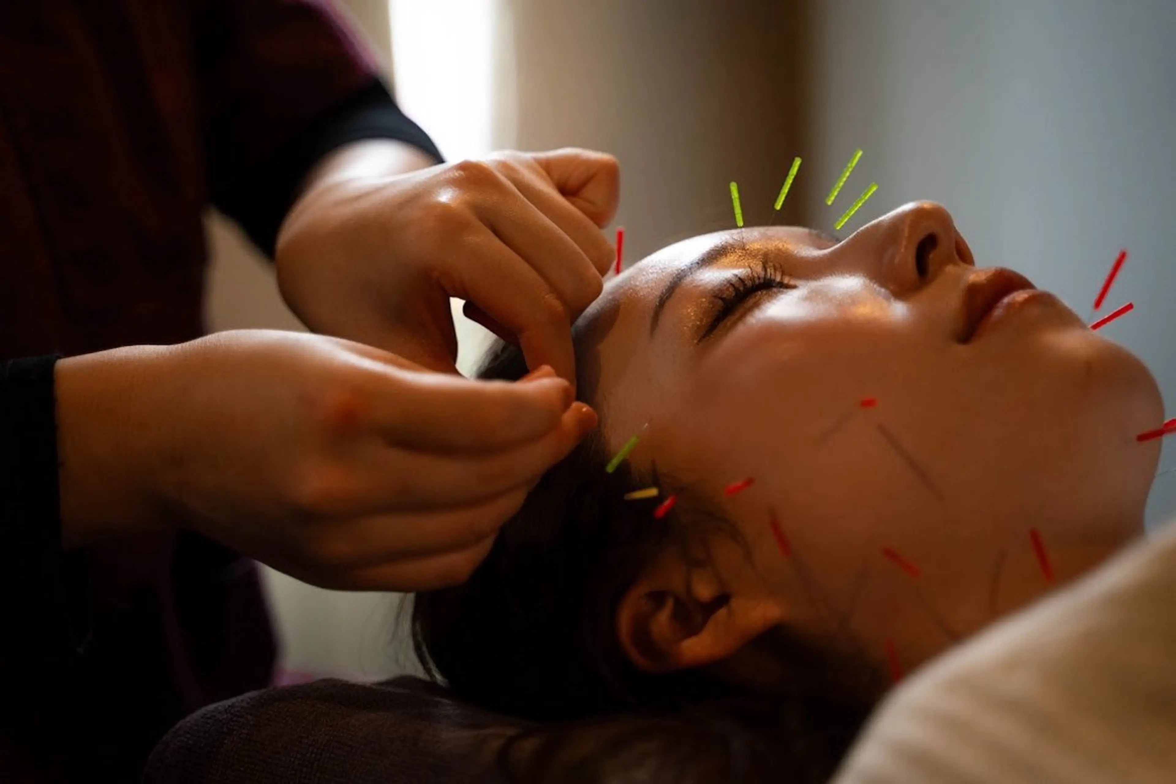 【あらゆるお肌の問題に！】　美容皮膚鍼灸　　60分　¥6980→¥5980の写真