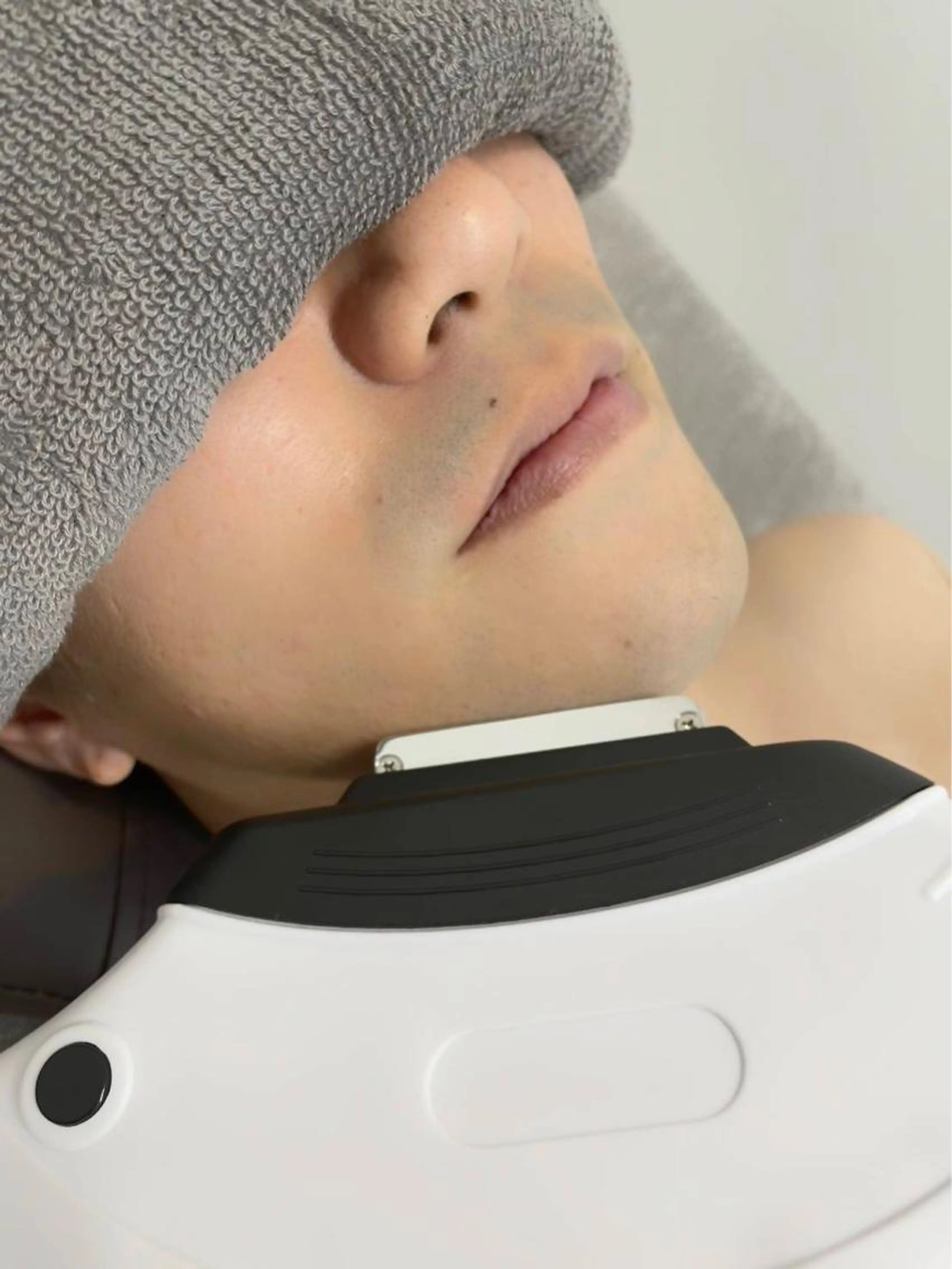 【ミニモ初回限定】お試しヒゲ脱毛1100円(1h)の写真