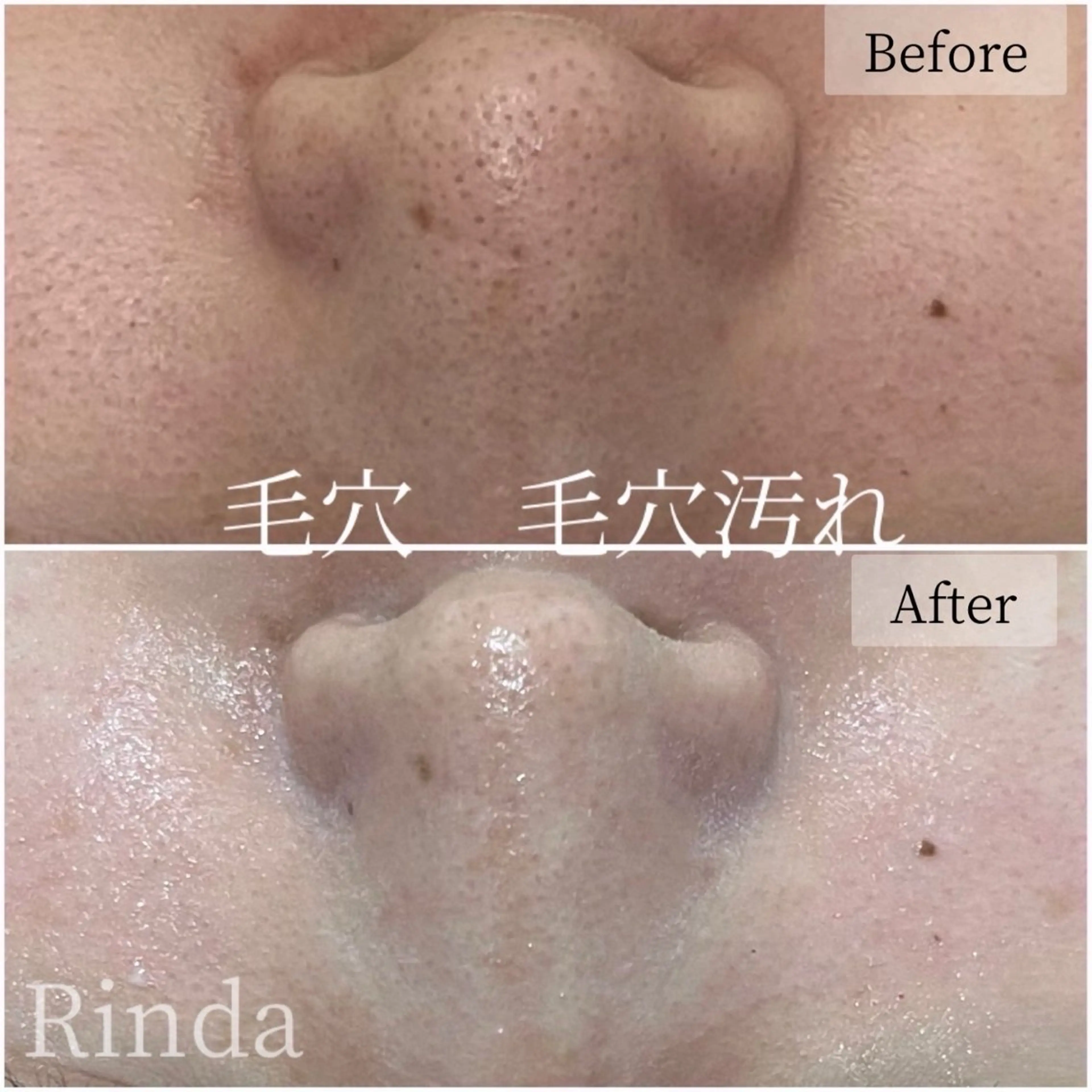 エステ ブライダル痩身×脱毛 尼崎駅前サロンのエステ・リラクイメージ