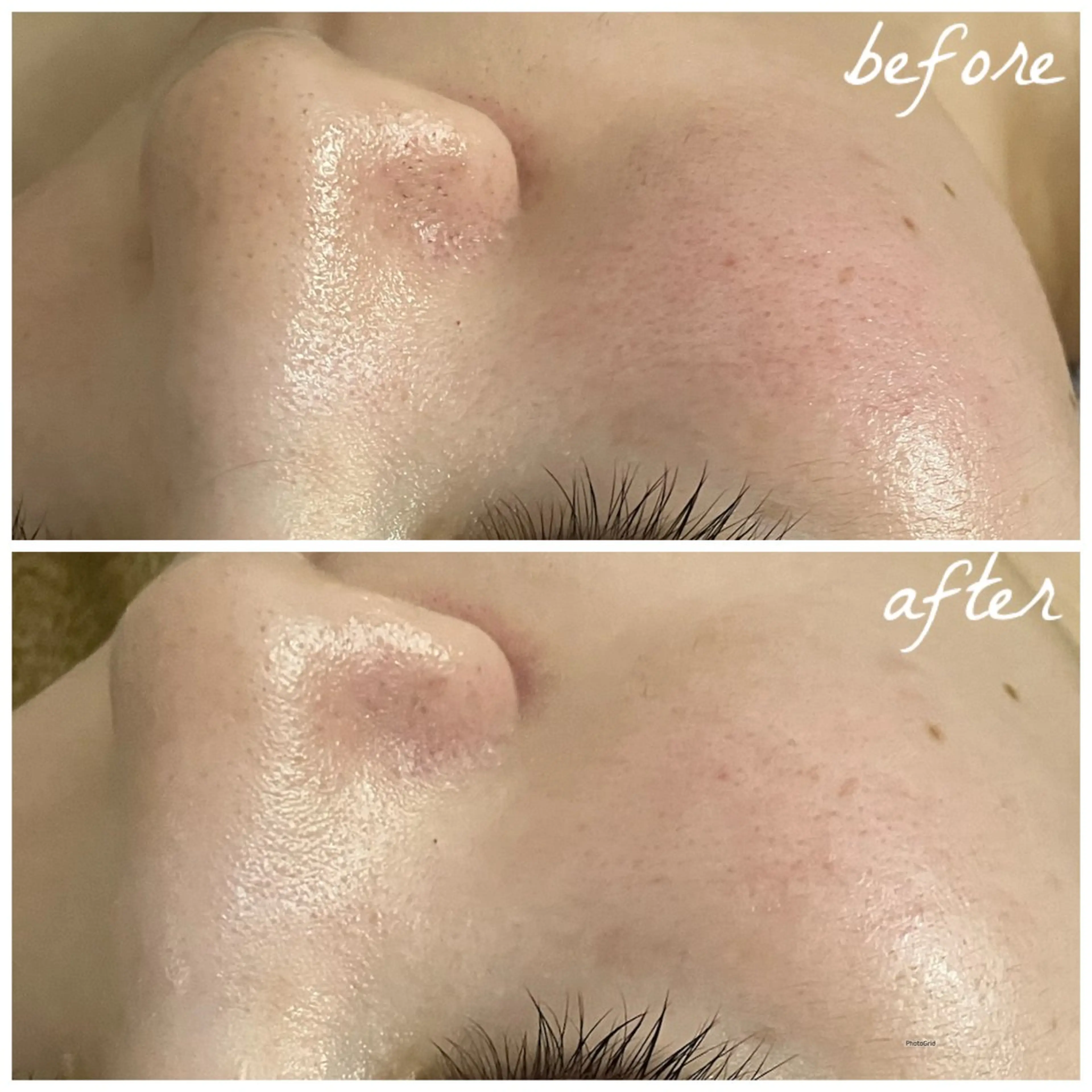 メンズ エステ メナード岐阜市茜部 杉浦のエステ・リラクイメージ