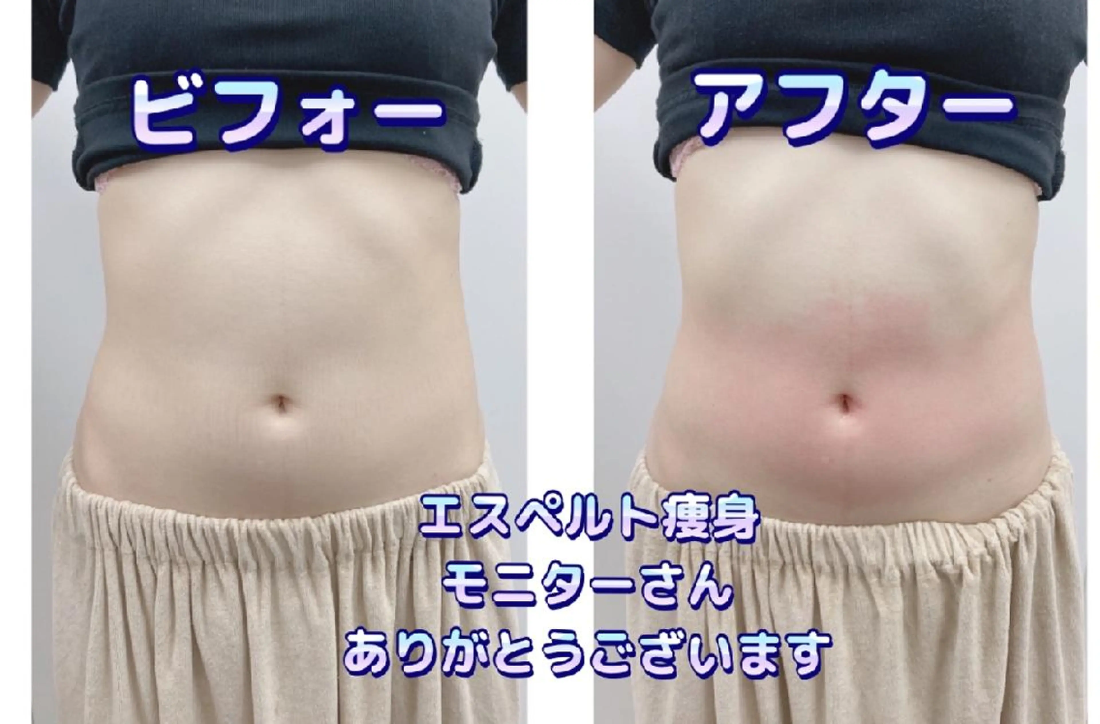 ショールームエステ becoのエステ・リラクイメージ