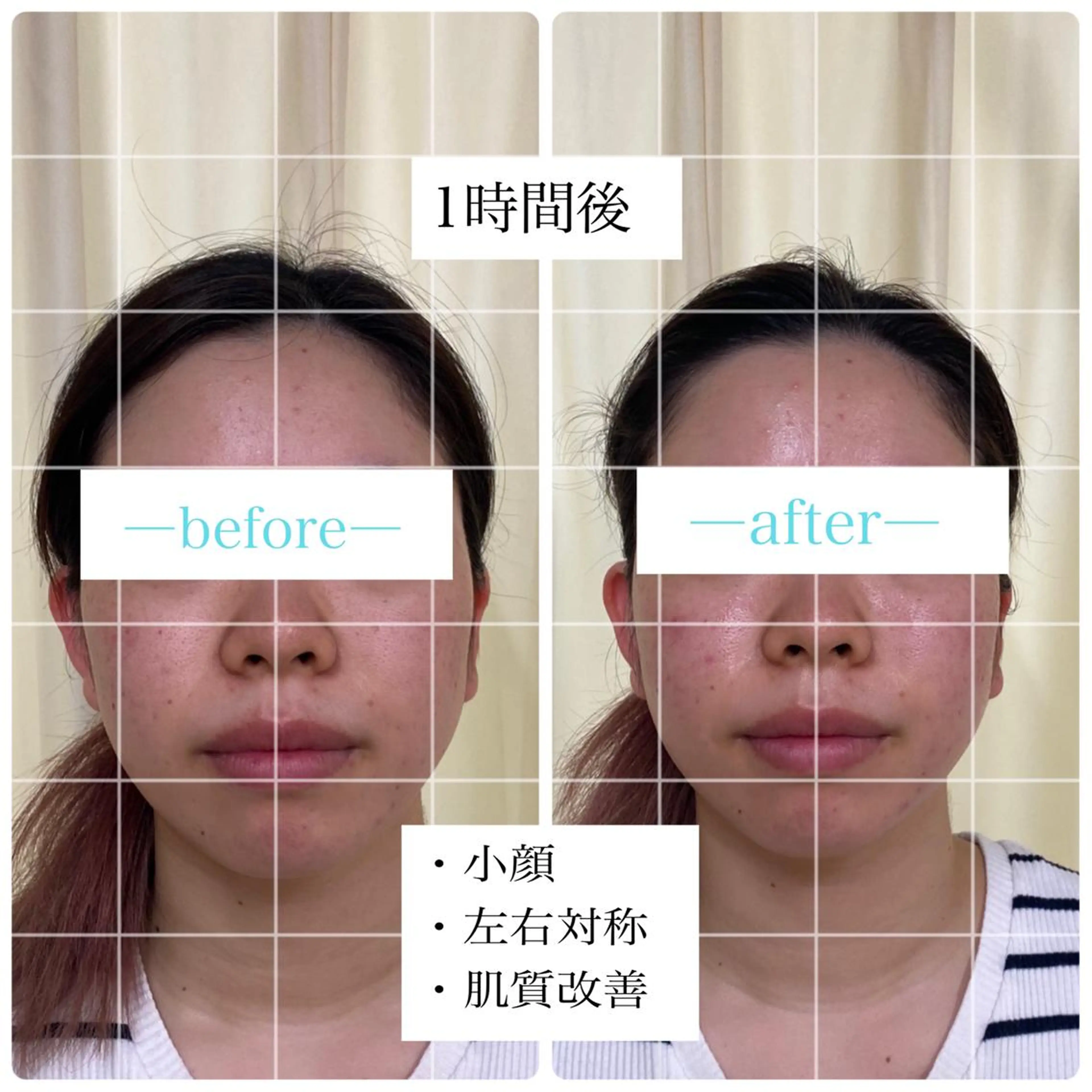 その他 BBB3(ビースリー)所属・鍼灸サロン BBB3のその他イメージ