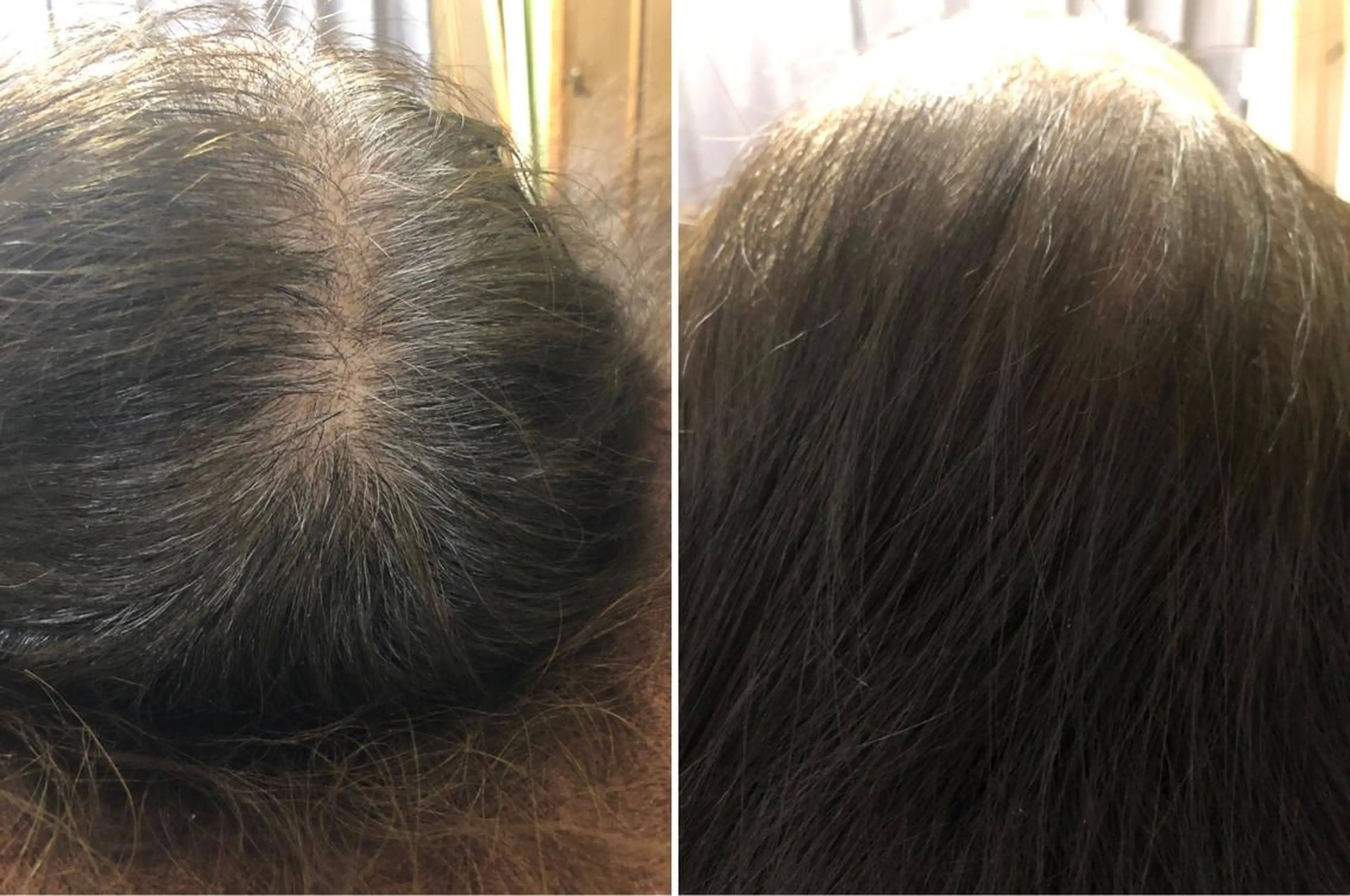 ヘアアレンジ セントラル鍼灸院 Re:laxyのヘアスタイル