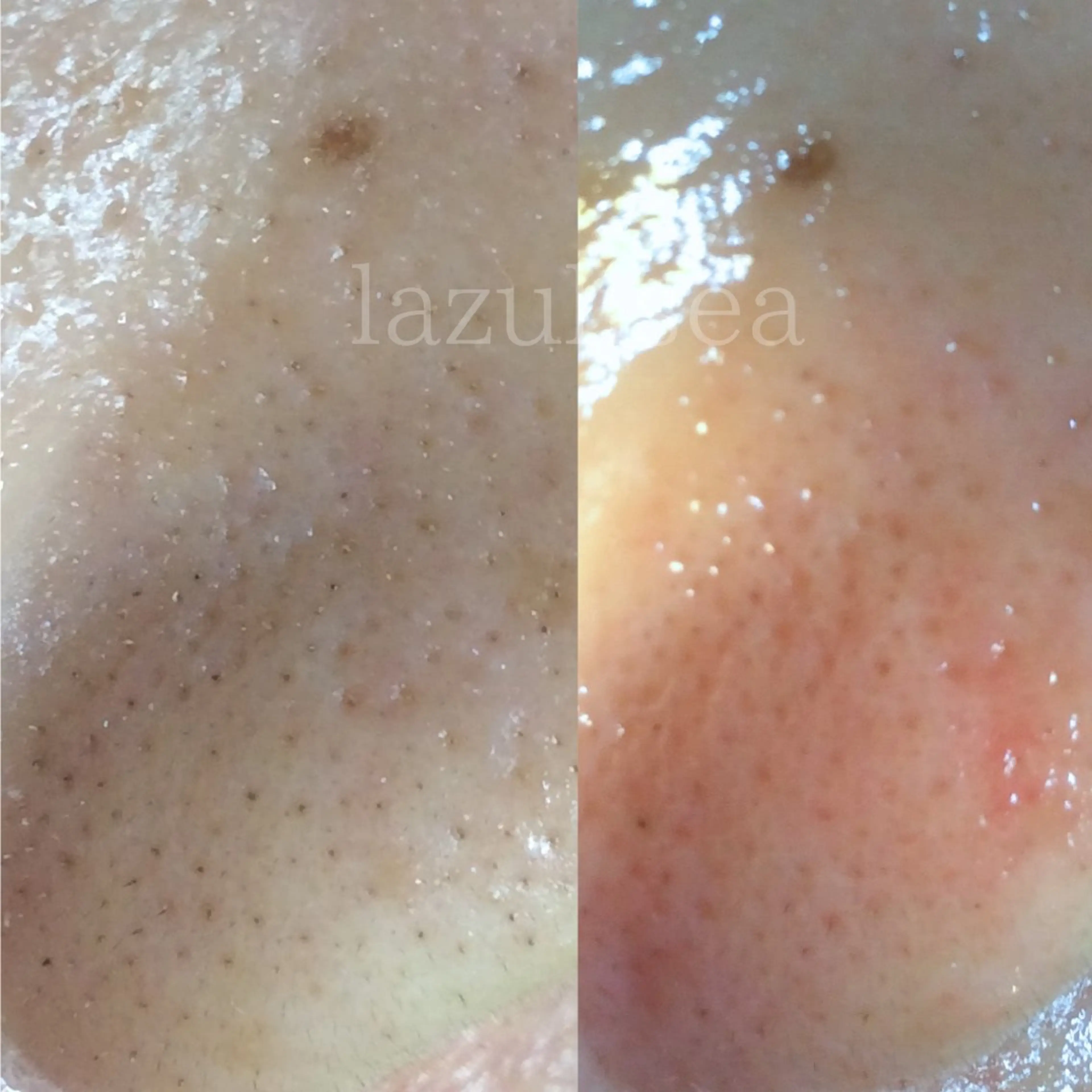 エステサロン　Lazulisea所属・川口 春奈のエステ・リラクイメージ