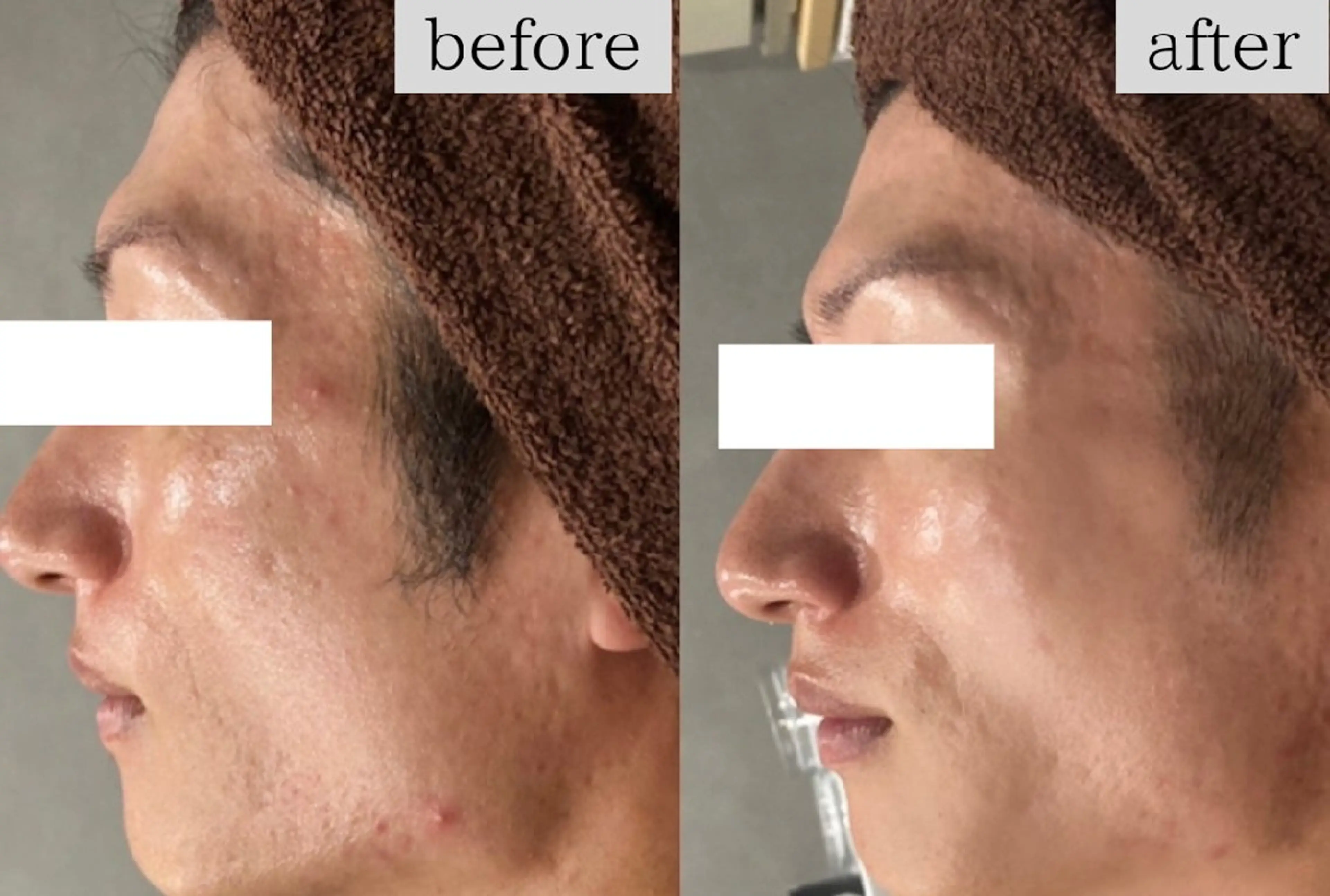 メンズ エステ Dahlia痩身脱毛 フェイシャル 中村のエステ・リラクイメージ