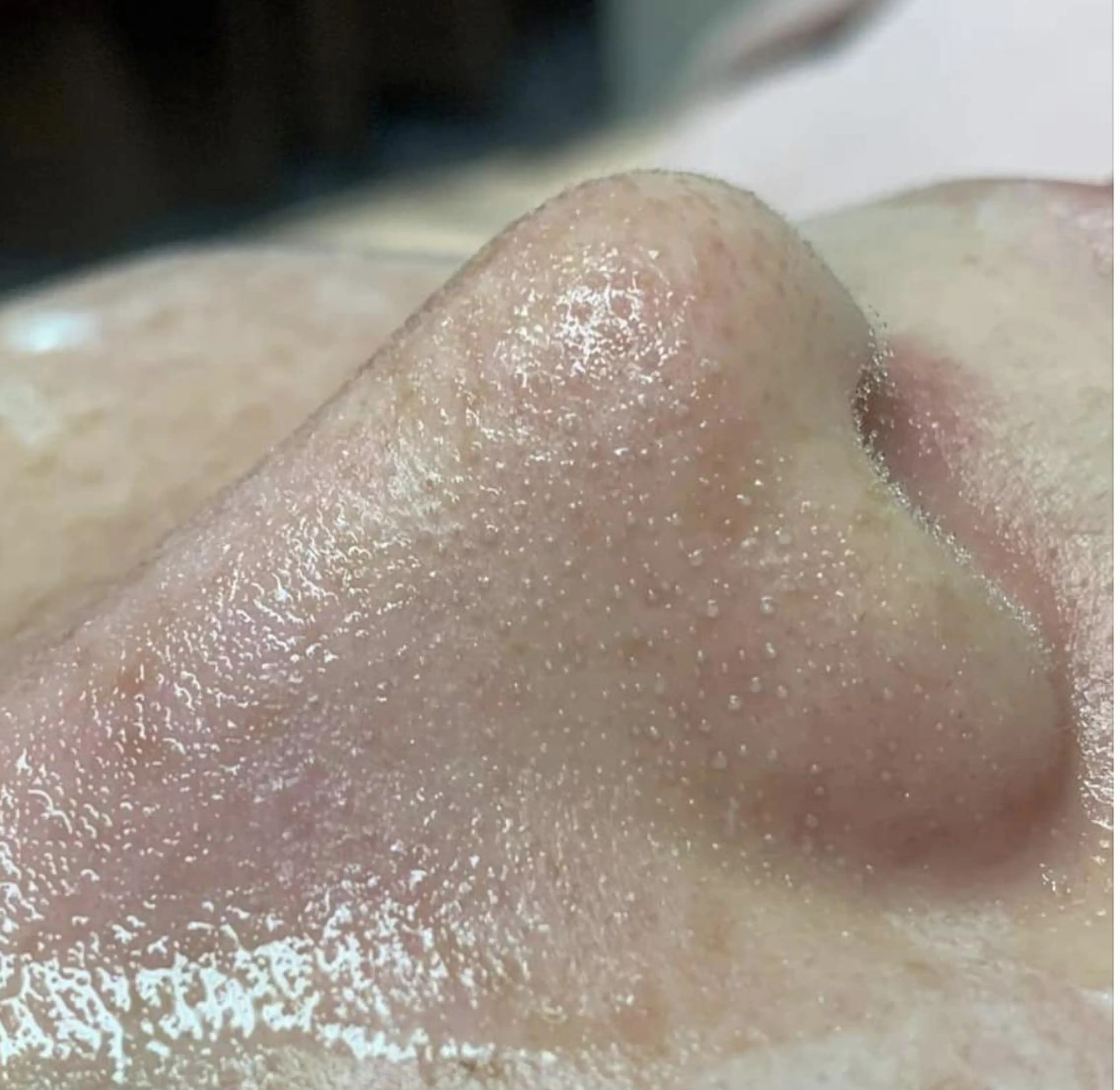 毛穴フェイシャル エステ専門店BBのエステ・リラクイメージ