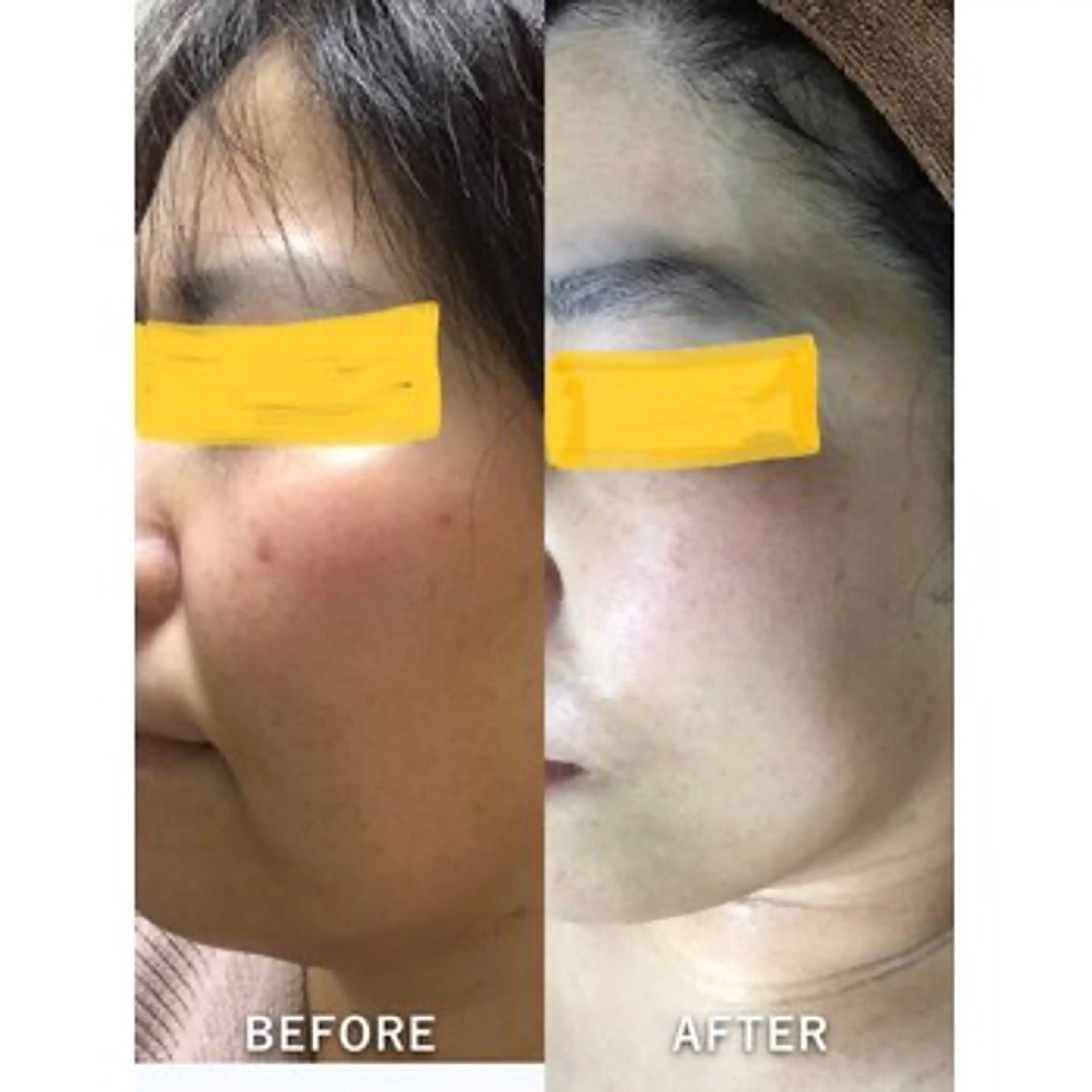 エステ 仲澤 千春のその他イメージ