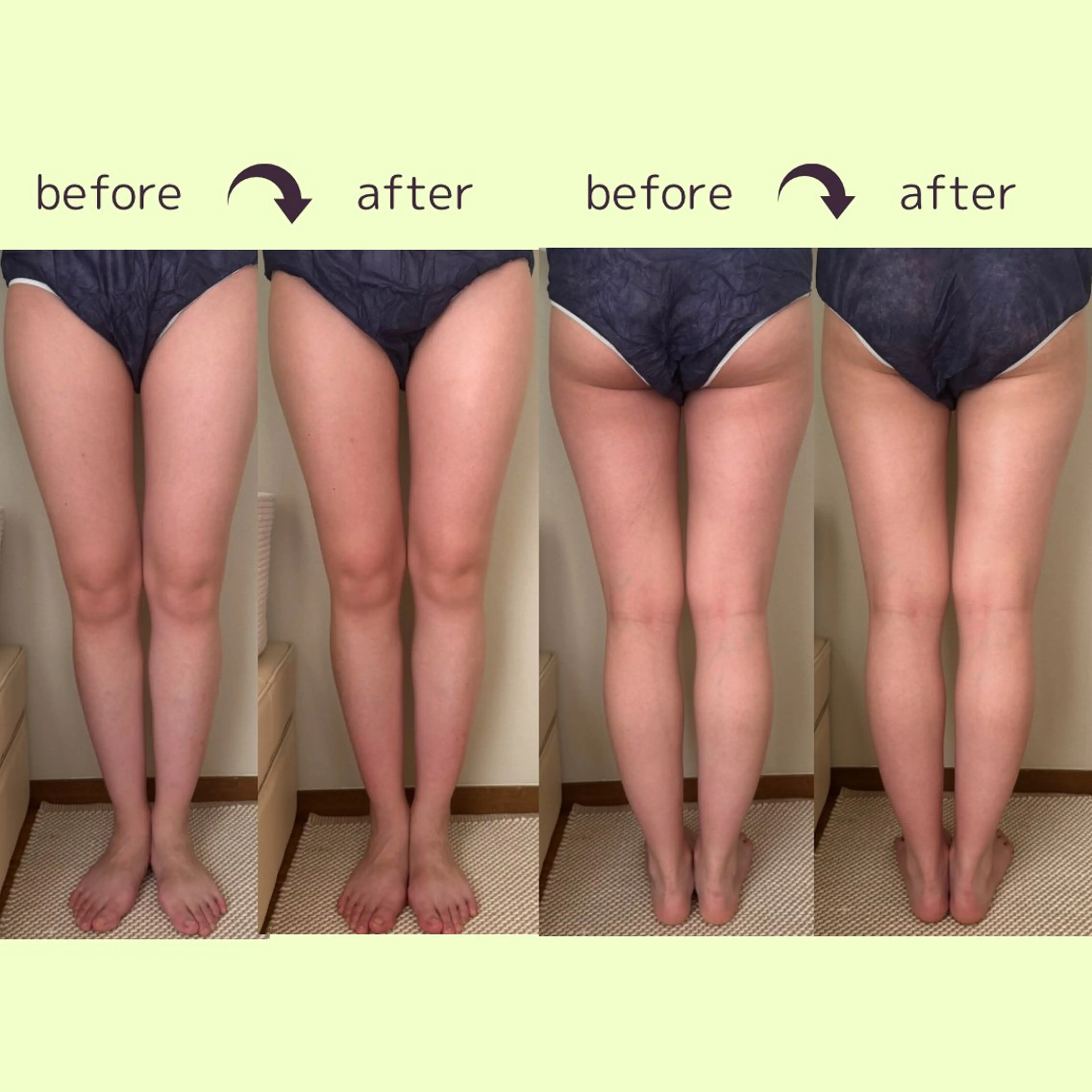 リラクゼーションスパ　ひのき所属・spaHINOKI 【女性専用】のエステ・リラクイメージ