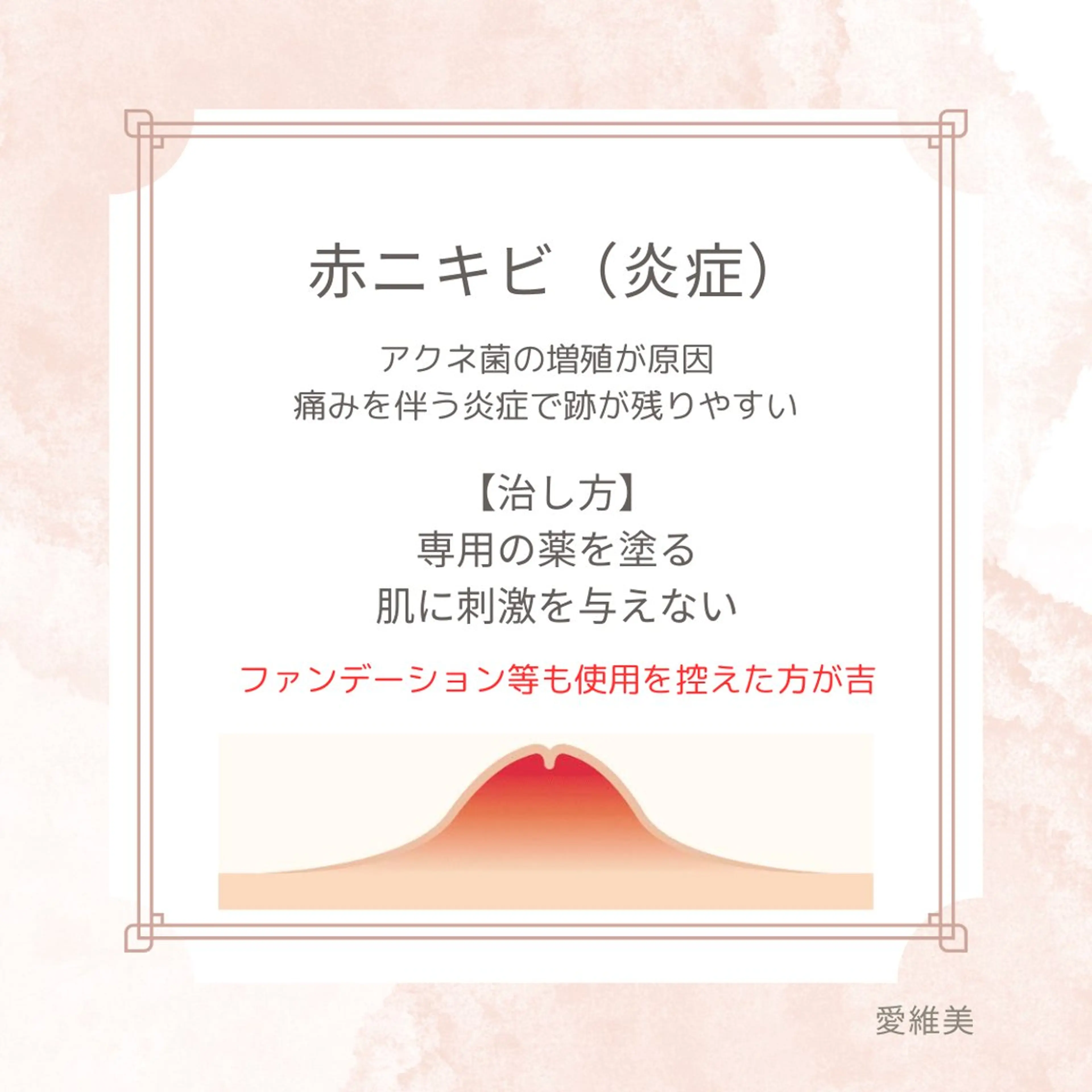 マツエク・マツパ エステ リラク 愛維美水光美肌専門店所属・愛維美水光美肌専門店 メンズレディースokのエステ・リラクイメージ