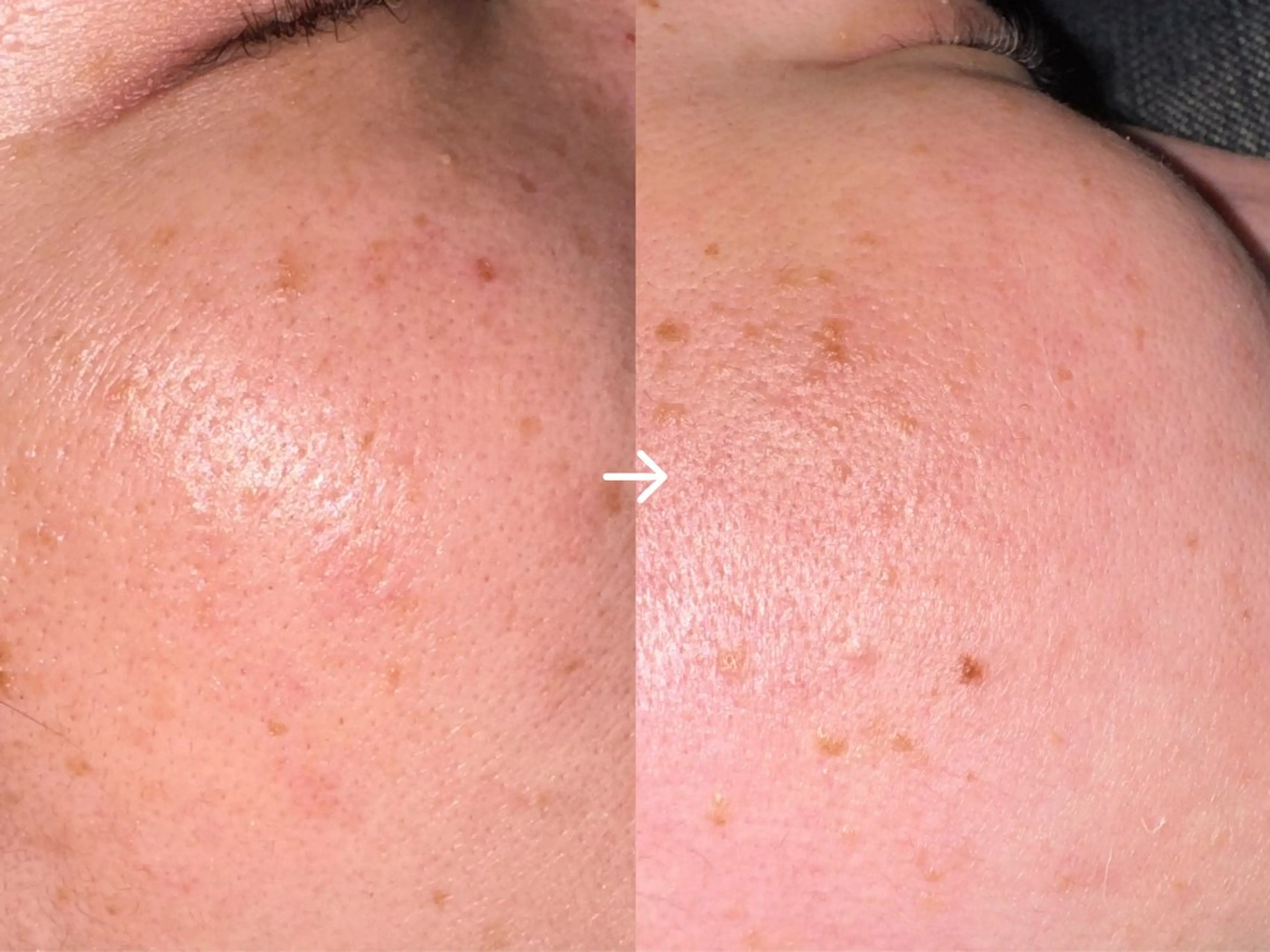 モテ眉/ Nanami🤍ྀིの眉毛・アイブロウイメージ