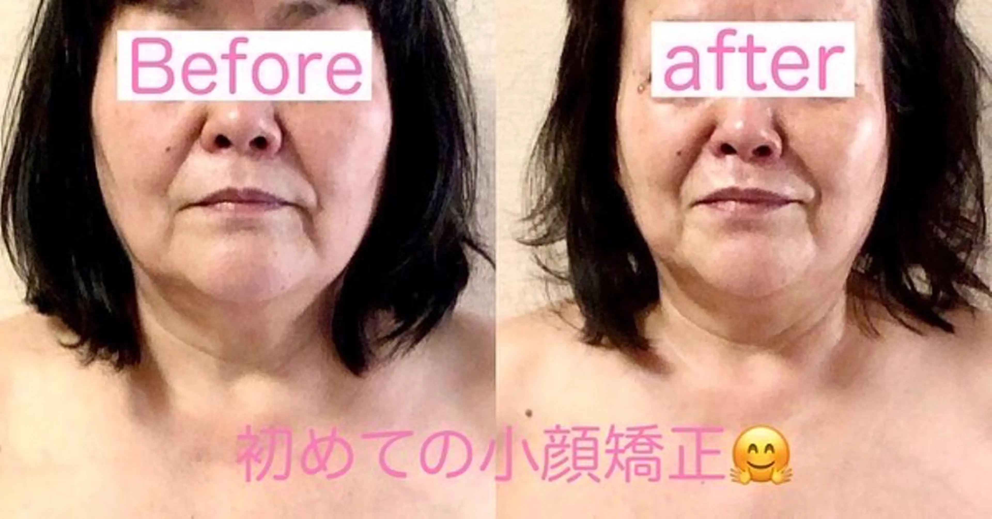 エステ リラク 小顔矯正&ヘッドスパ haruhandのエステ・リラクイメージ